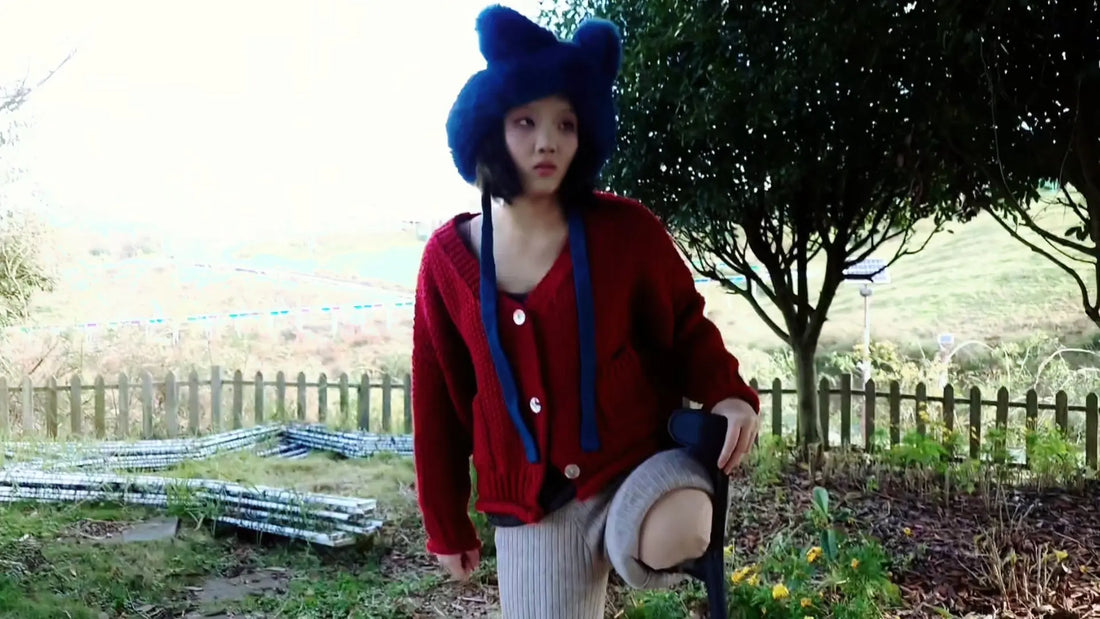Model story - Lingo's experience - AmputeeClub