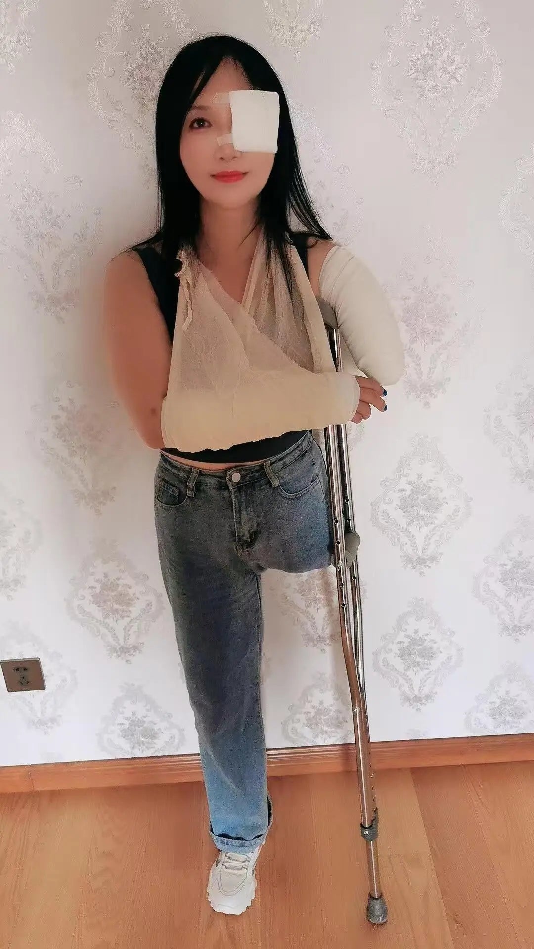 Lanzi OOE Amputee Girl - Injured limbs and eyes AmputeeClub