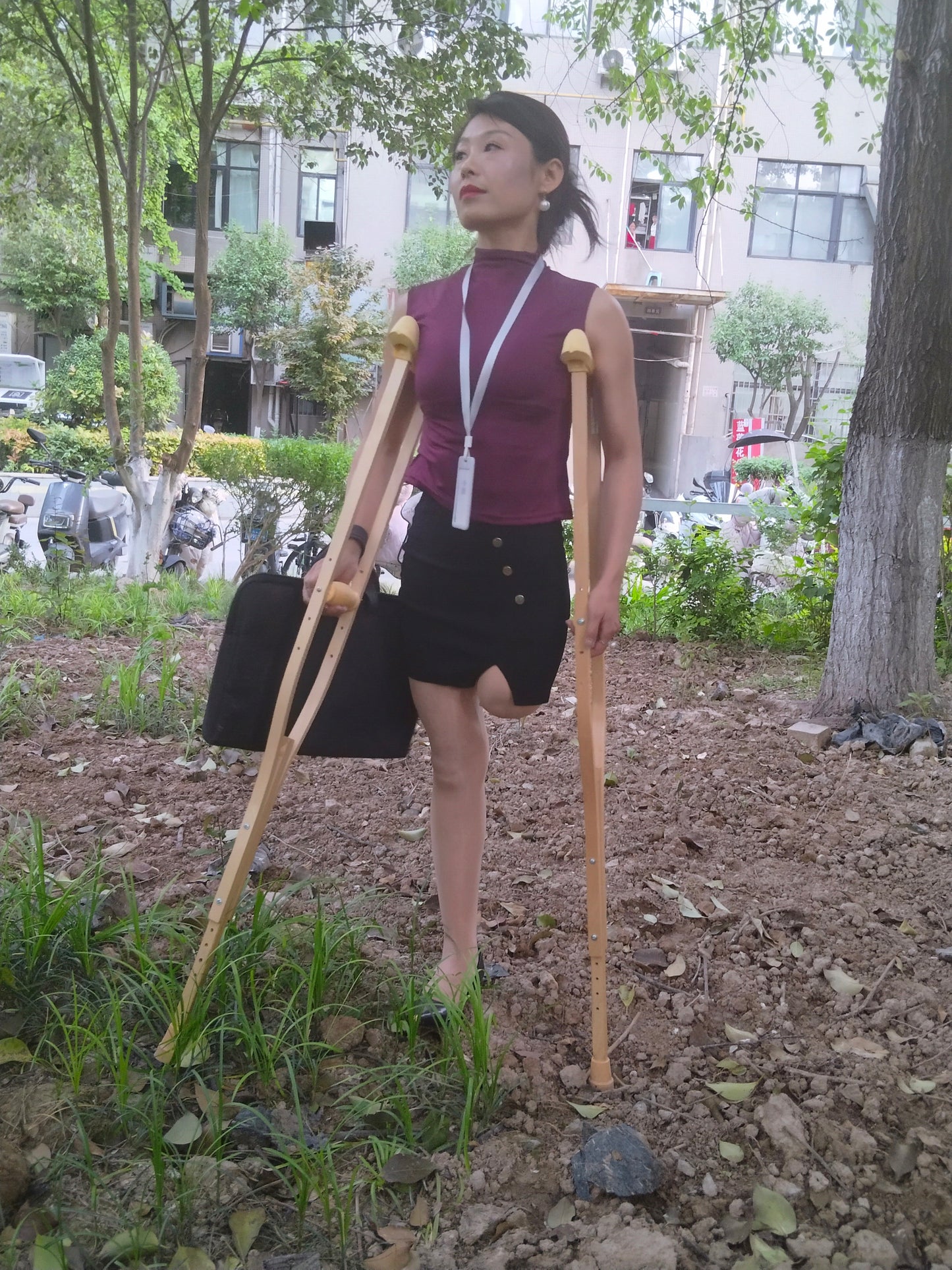 Ayla: Sak Amputee Girl - Learning to Use a New Prosthetic Limb