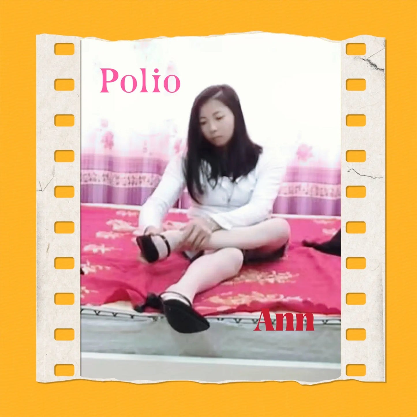 New model New video:"Ann:Polio Girl" AmputeeClub