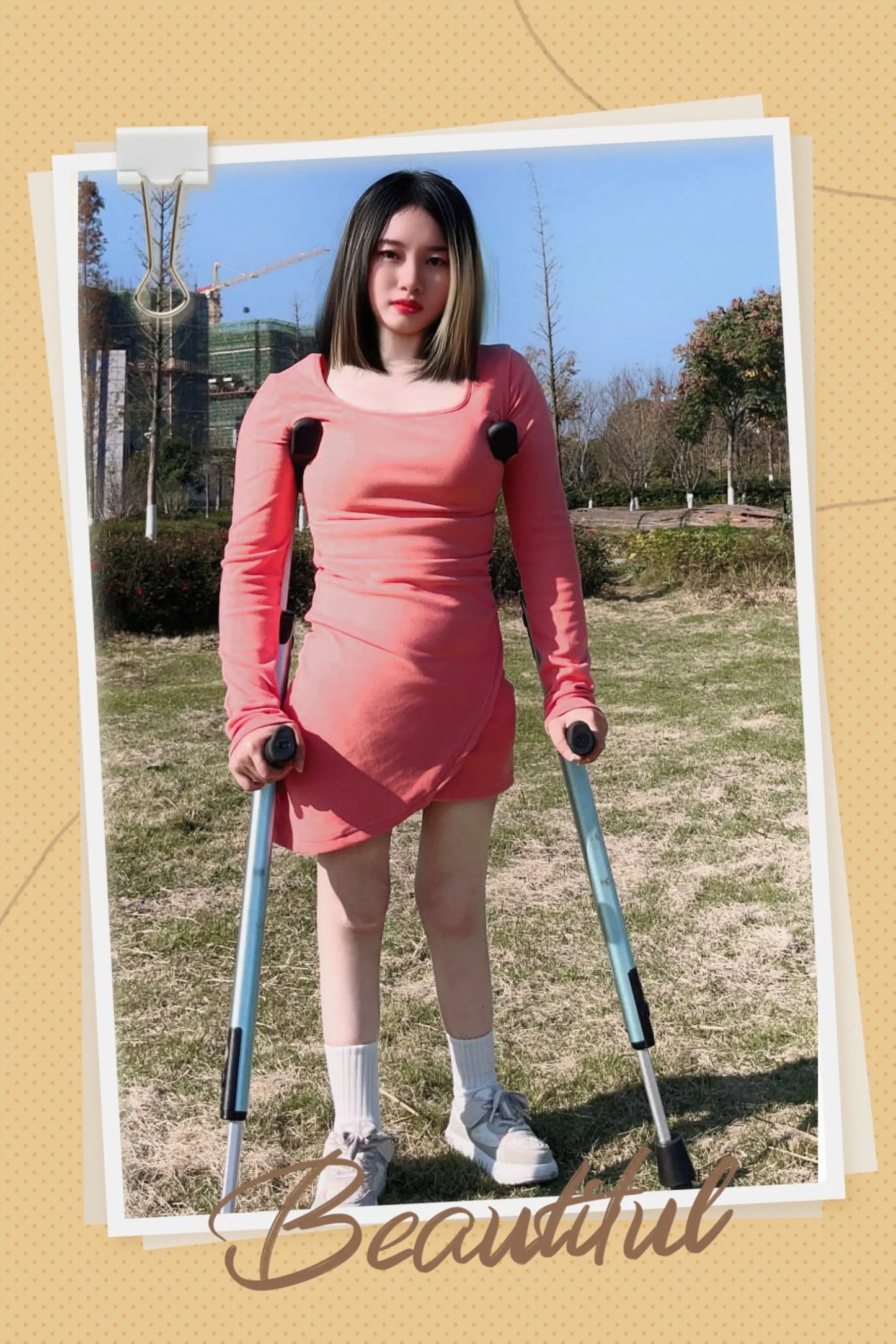 Miki:Girl With Her Little Feet AmputeeClub
