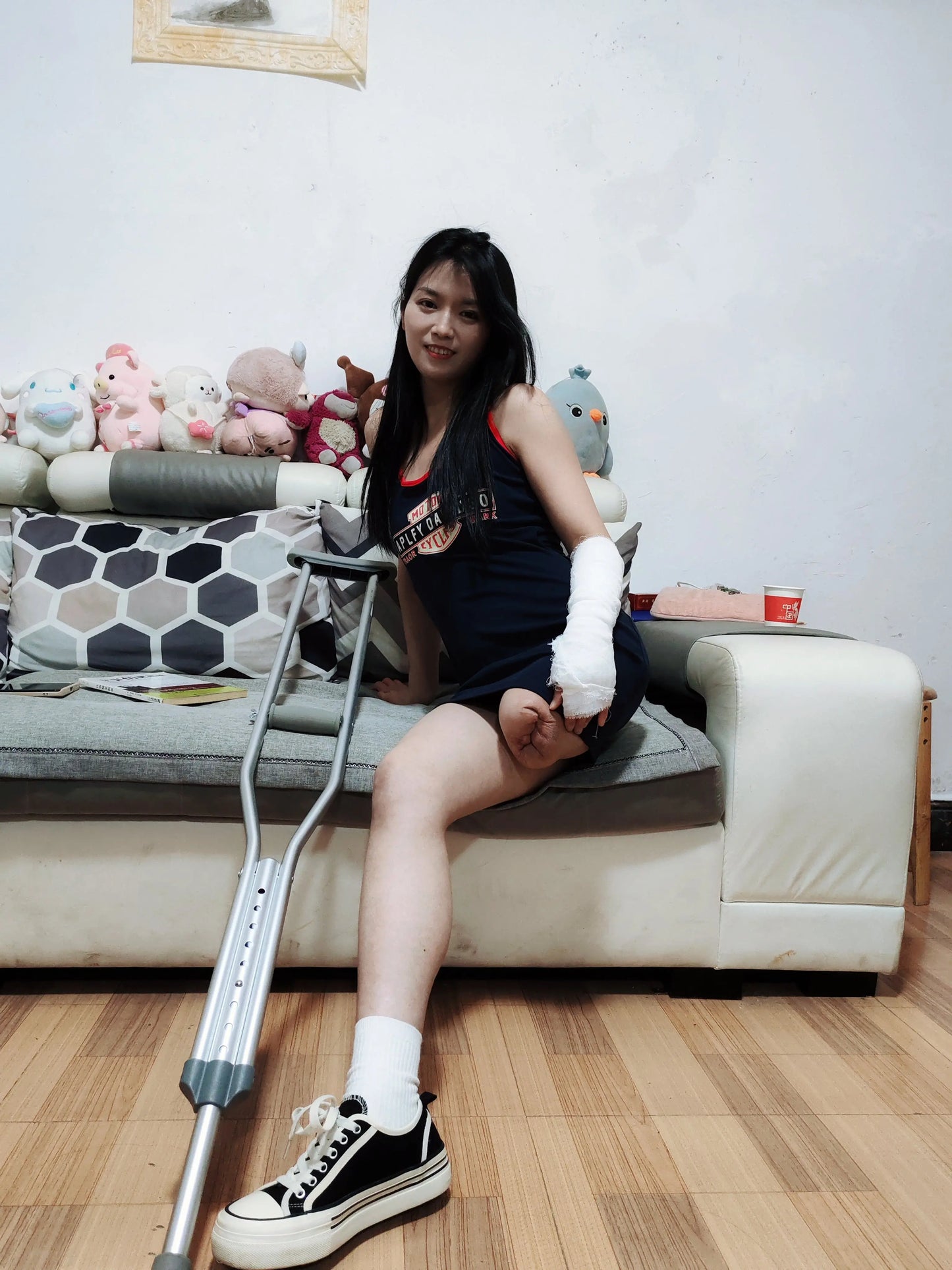 Alisa: Sak girl's hand is injured AmputeeClub