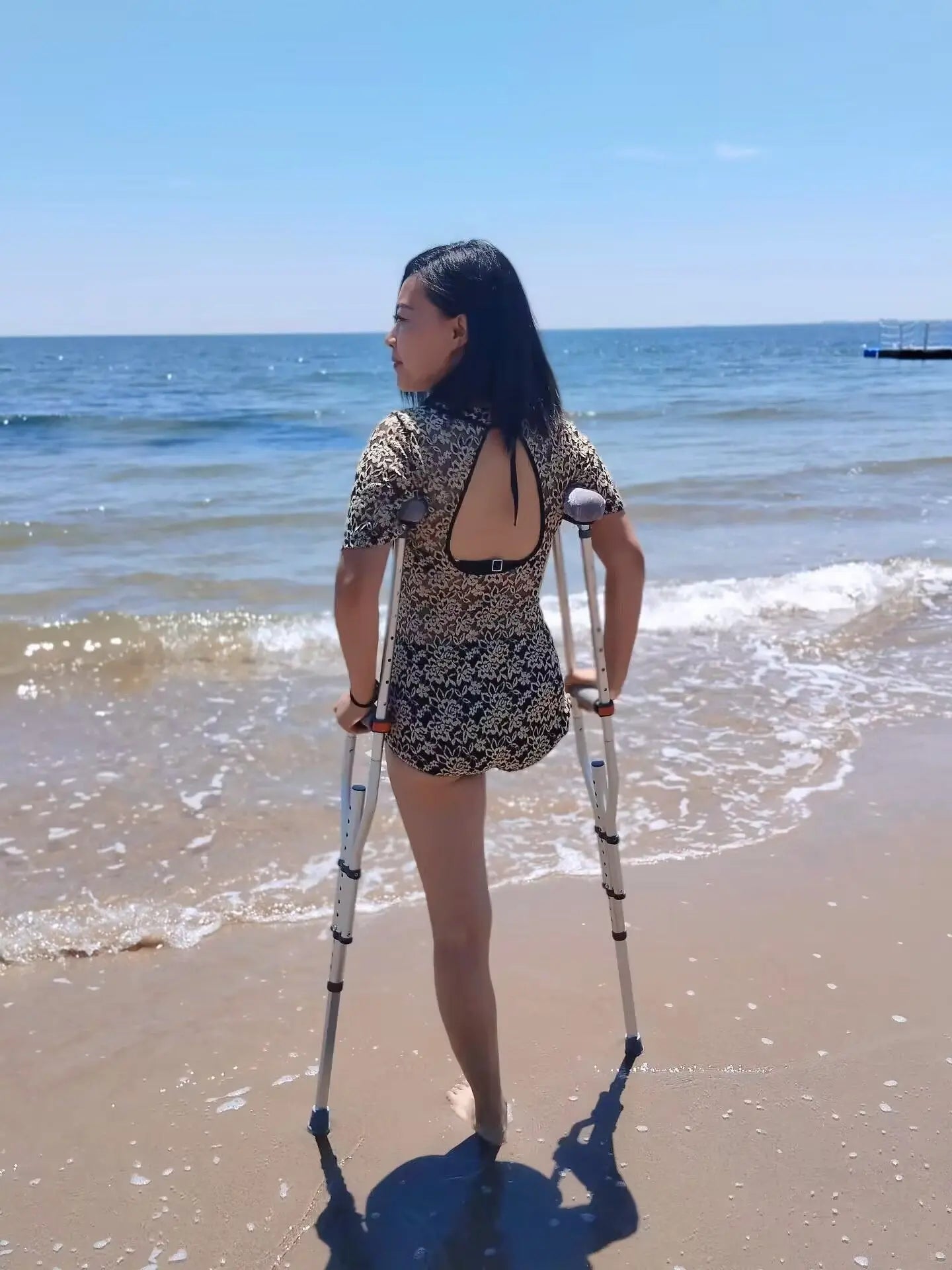 Emma: Shd Amputee lady on the beach AmputeeClub