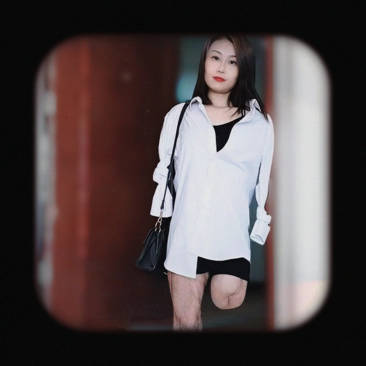 Ayla:Sak Amputee Girl Pretended Triple Amp AmputeeClub