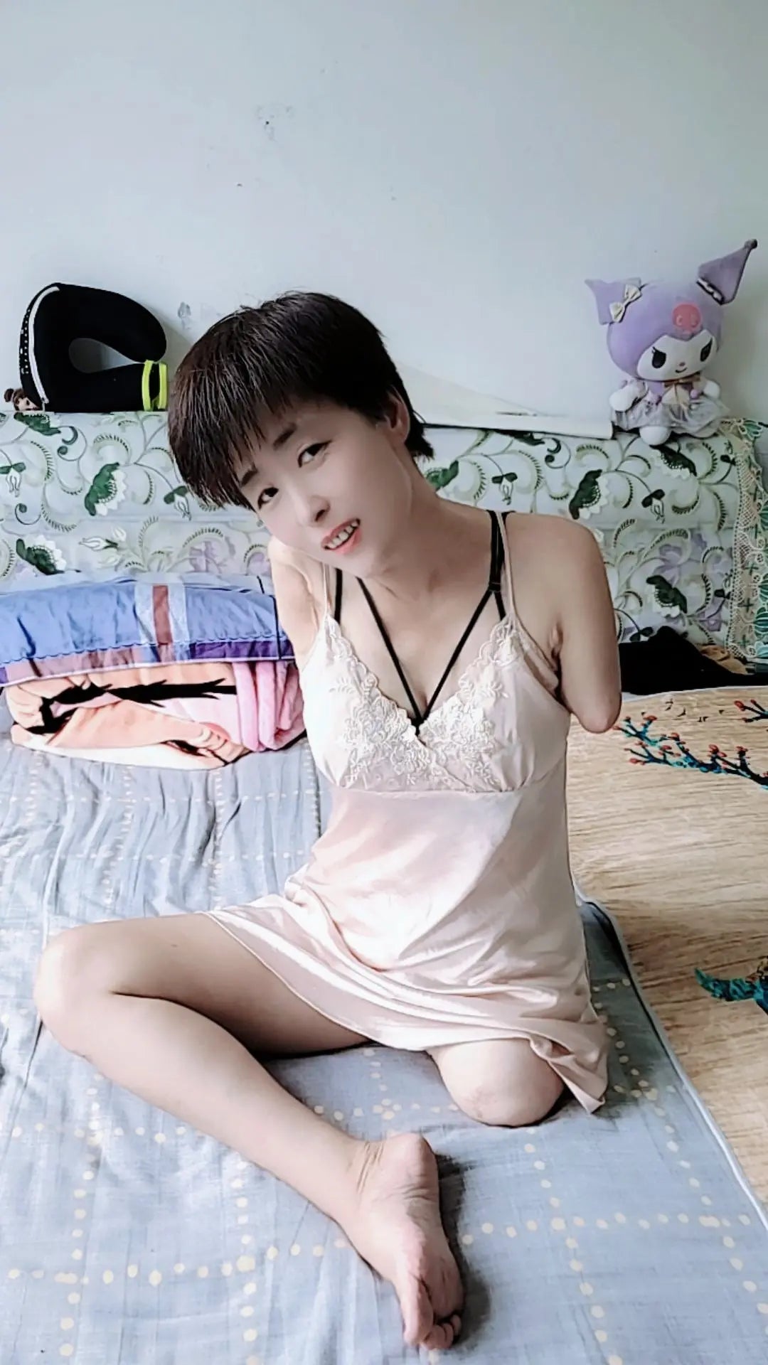 Mary: Triple Amputee Lady's Daily Life AmputeeClub