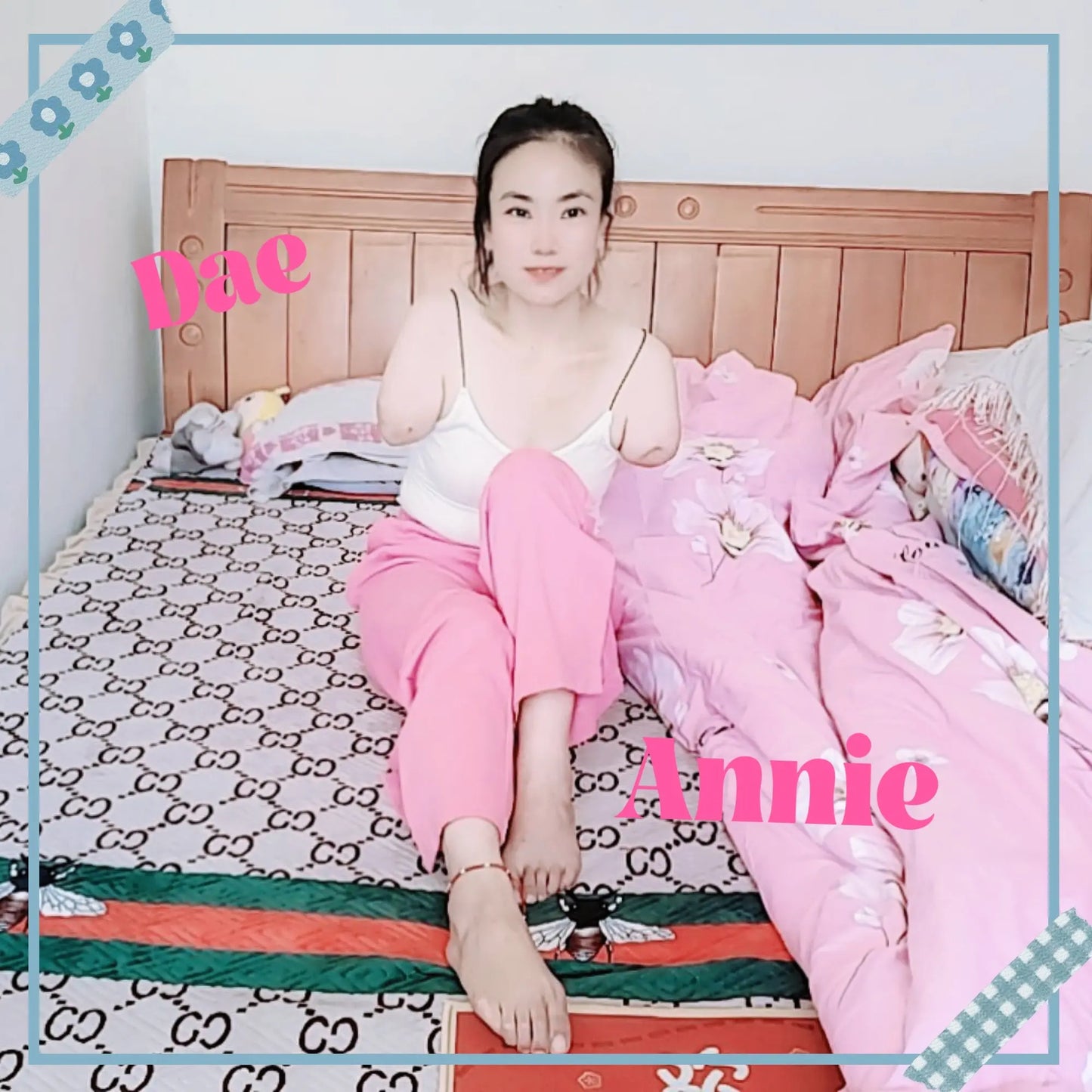 New model New video: "Annie Dae Amputee Girl" AmputeeClub