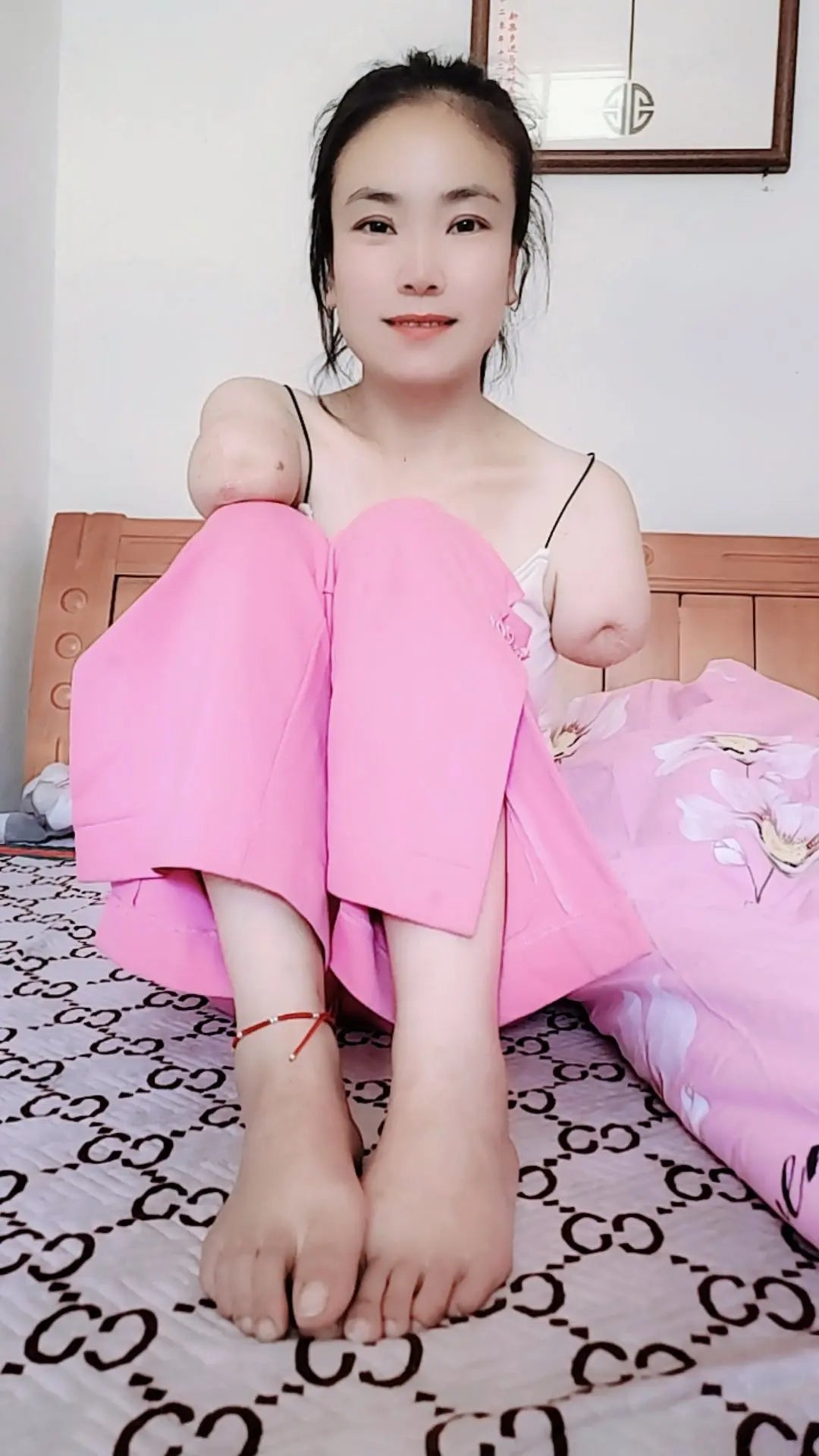 New model New video: "Annie Dae Amputee Girl" AmputeeClub