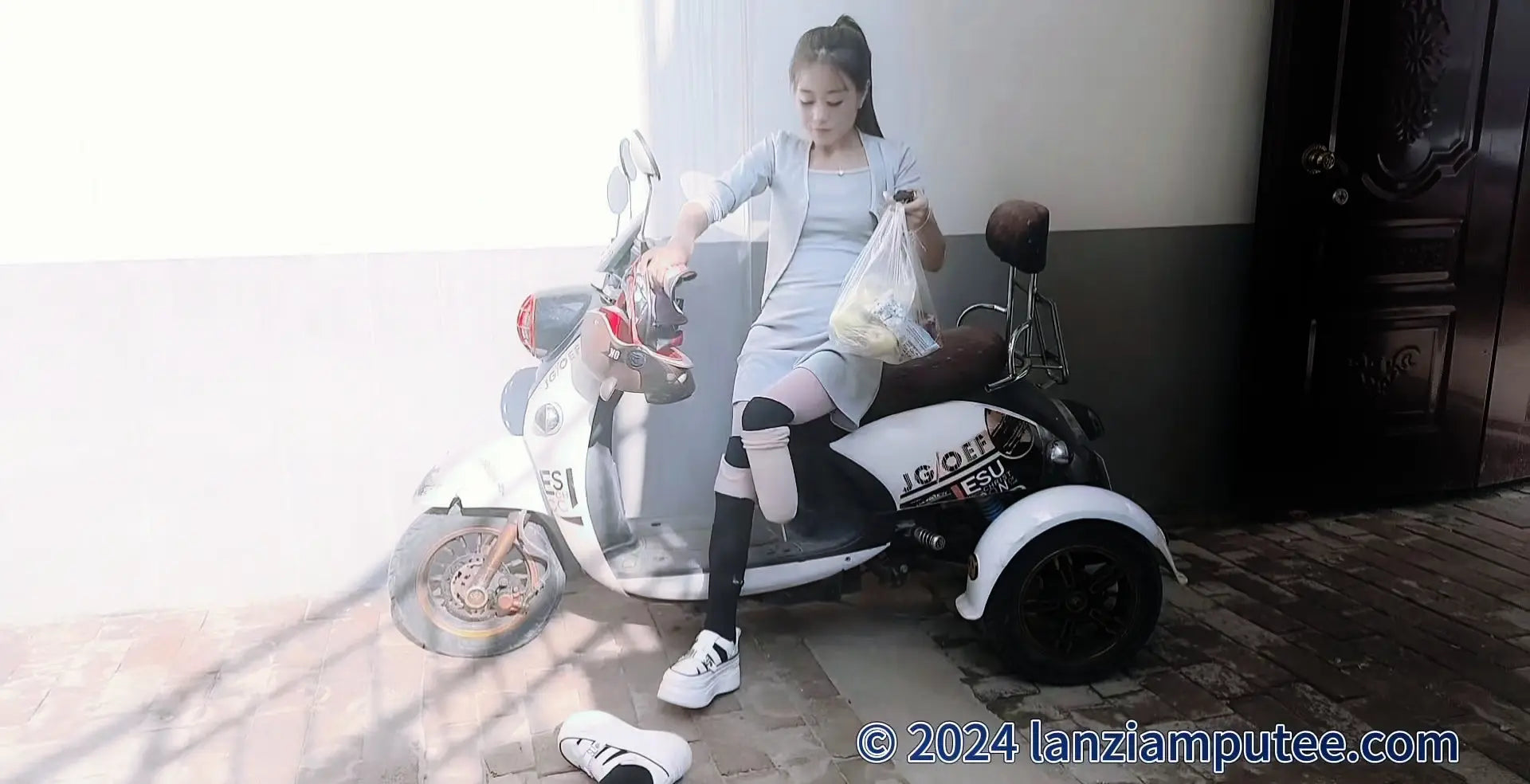 Cece: DBK Amputee girl's prosthetic falls out AmputeeClub