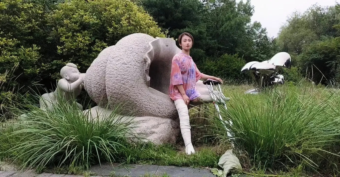 Ayla: Sak Amputee Girl leg cast AmputeeClub