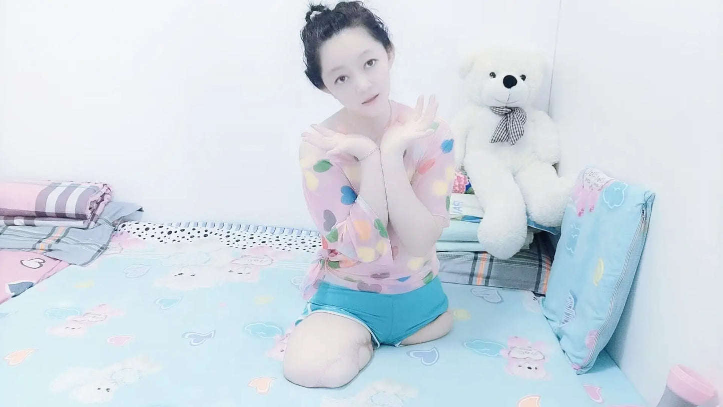 Sugar: Dak(Ak+Hd) Amputee Girl wakes up AmputeeClub