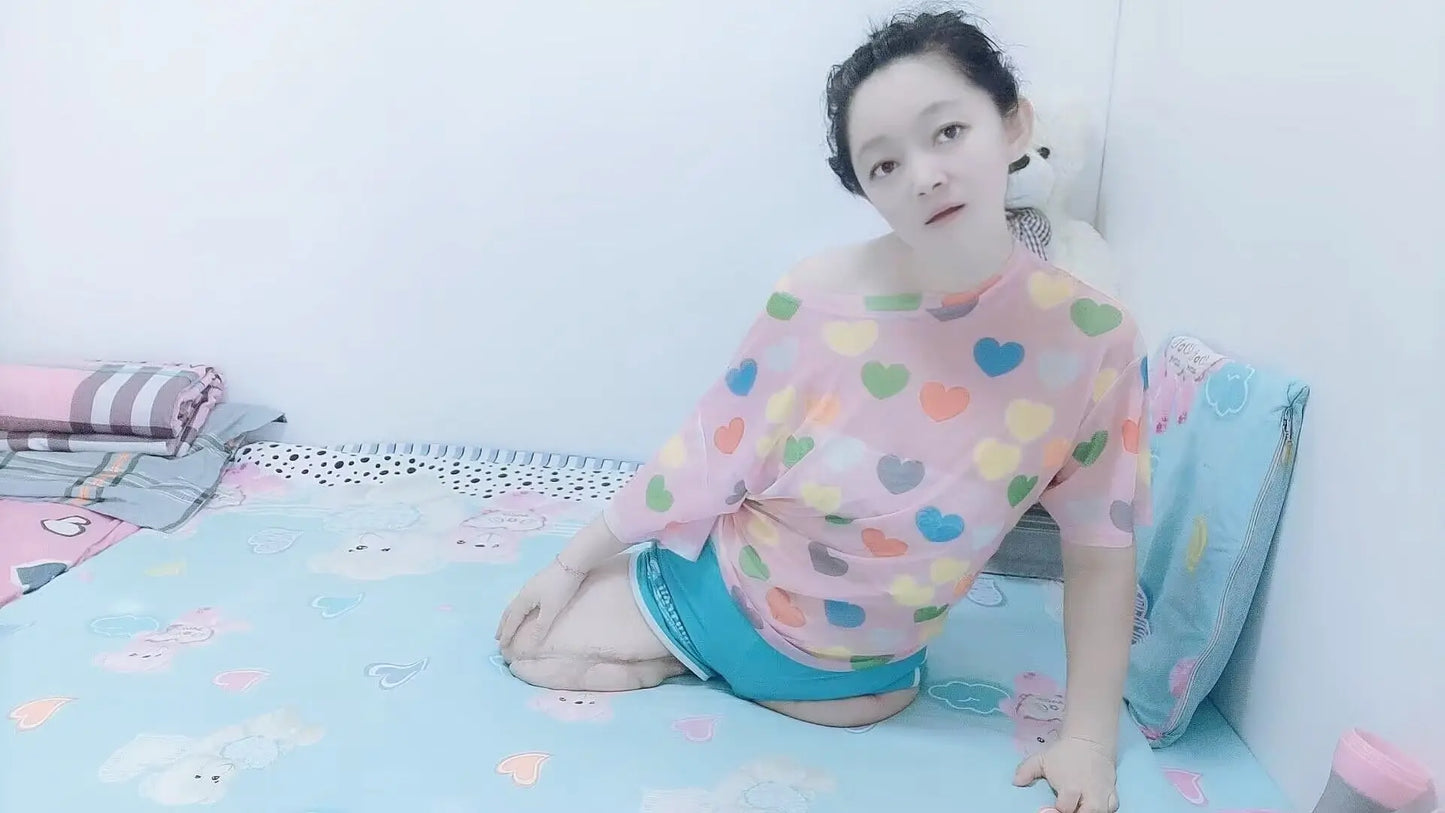 Sugar: Dak(Ak+Hd) Amputee Girl wakes up AmputeeClub