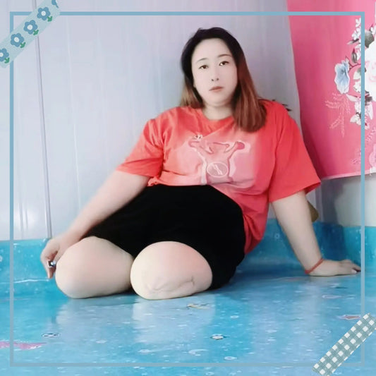 Beryl: Dak Amputee Girl without legs and leg prosthetics AmputeeClub