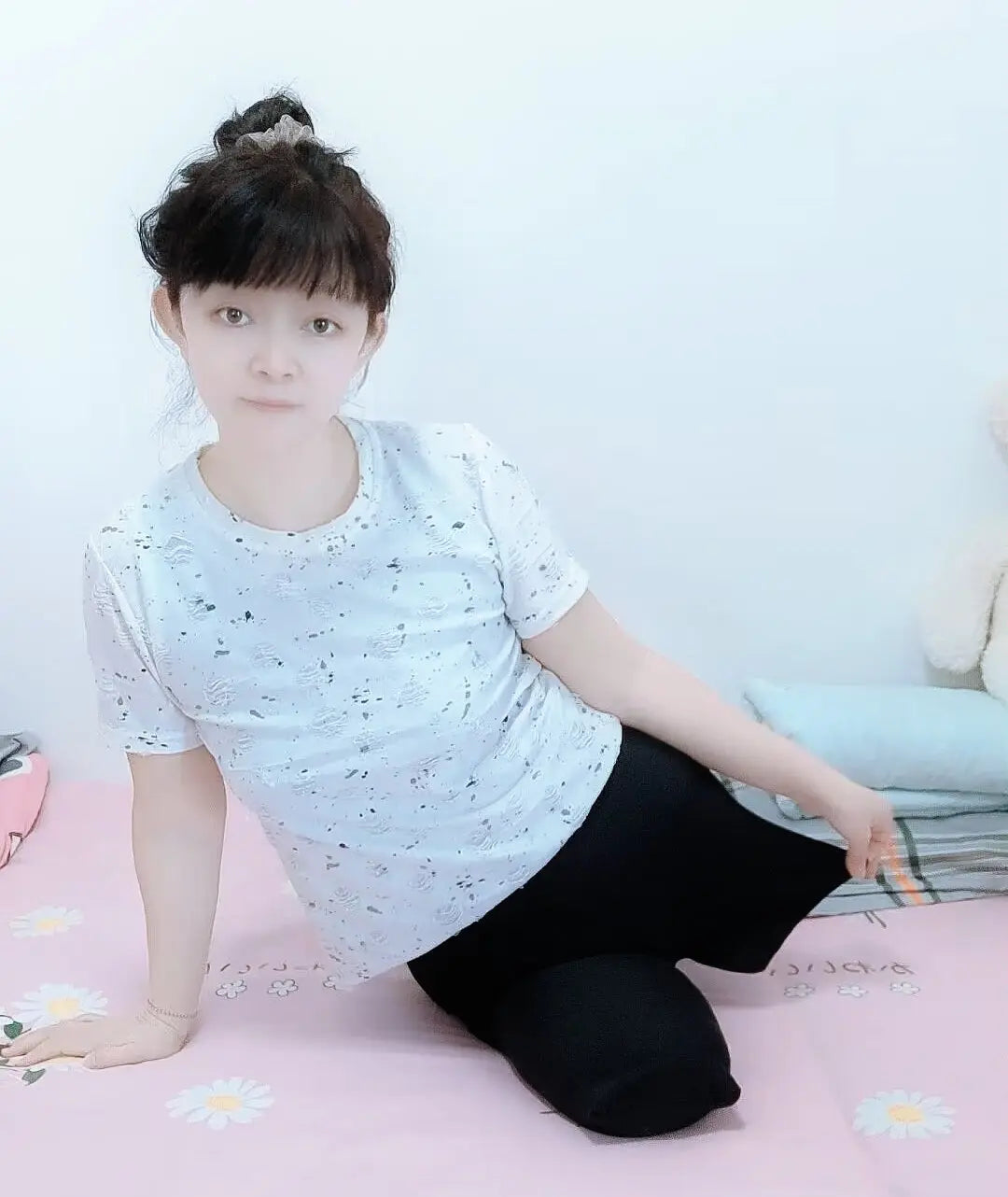 Sugar: Dak(Ak+Hd) Amputee Girl gets up AmputeeClub