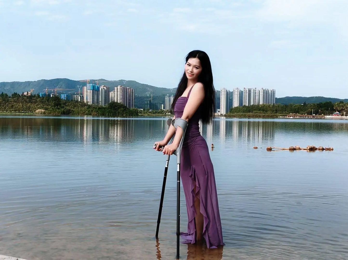 Alisa: Sak Amputee Girl walks by the lake wearing purple clothes AmputeeClub
