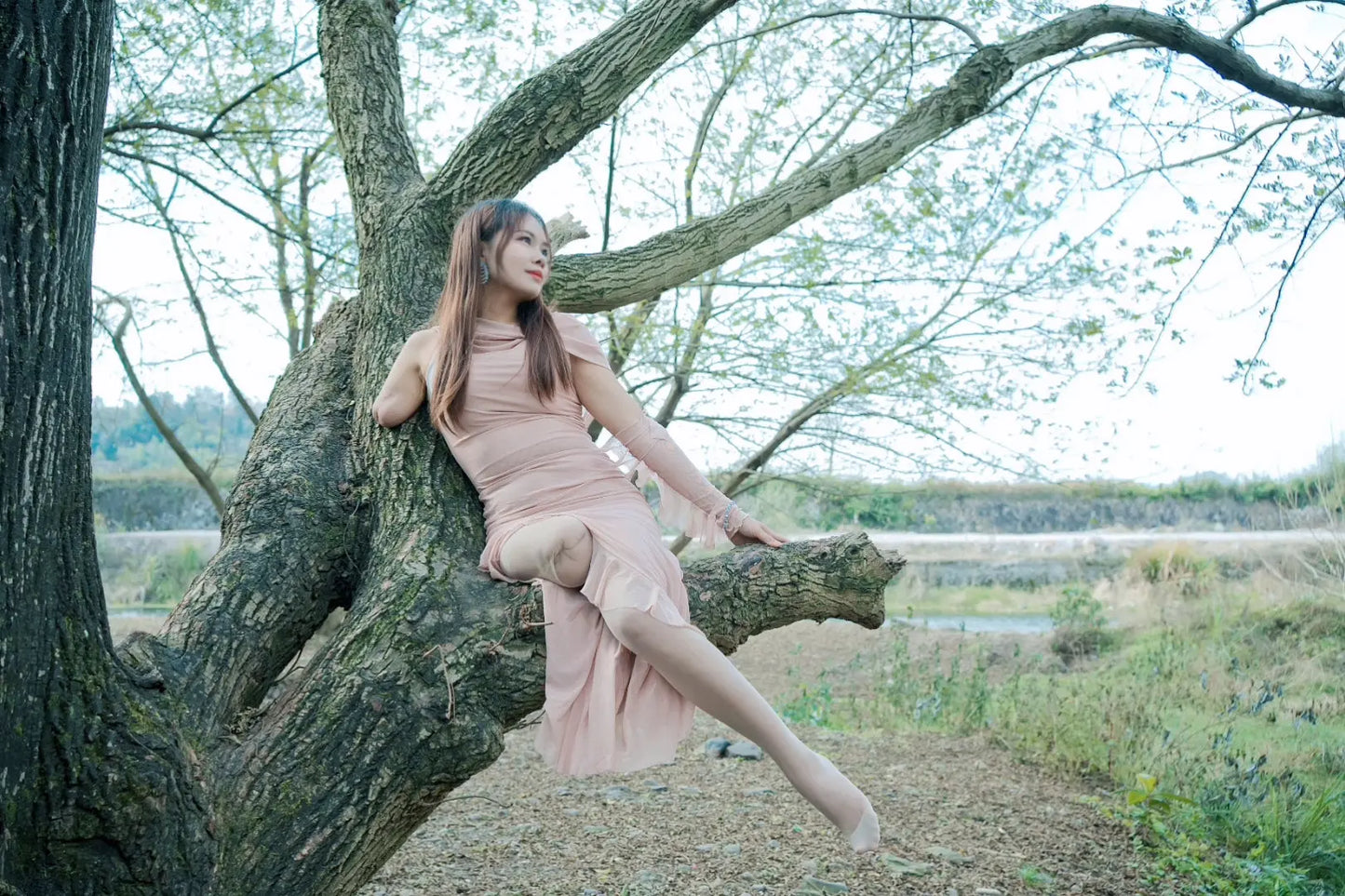 Abby: Ooe Amputee Girl - A girl wearing a pink long dress AmputeeClub