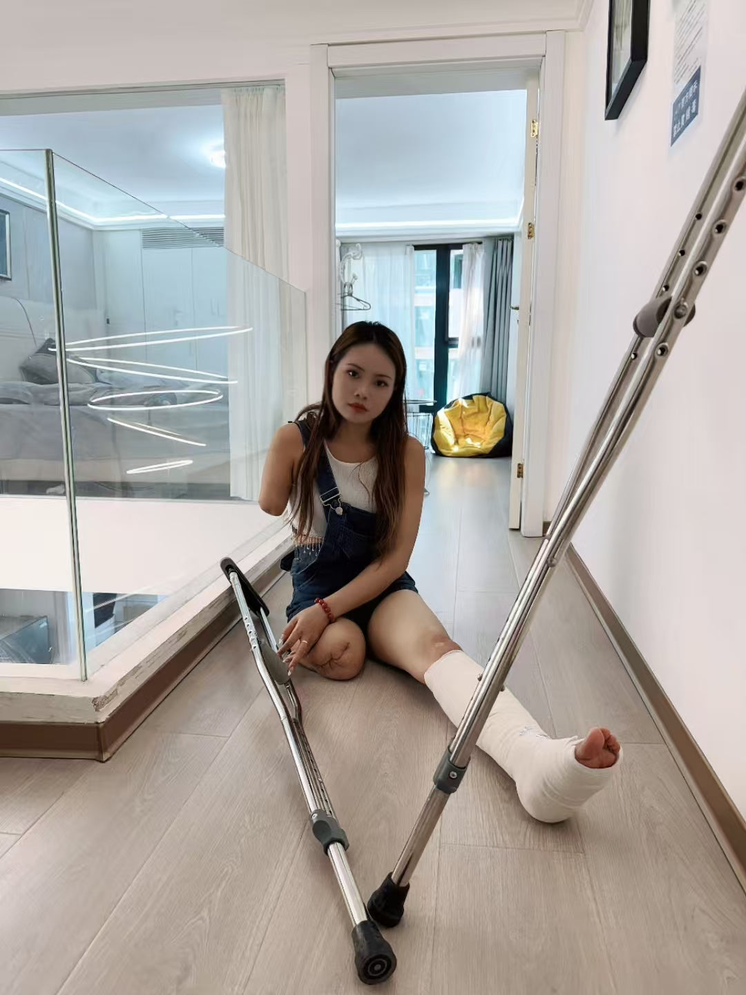 Abby: Ooe Amputee Girl - The Only Leg Cast
