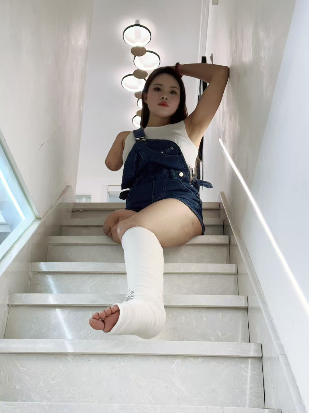 Abby: Ooe Amputee Girl - The Only Leg Cast