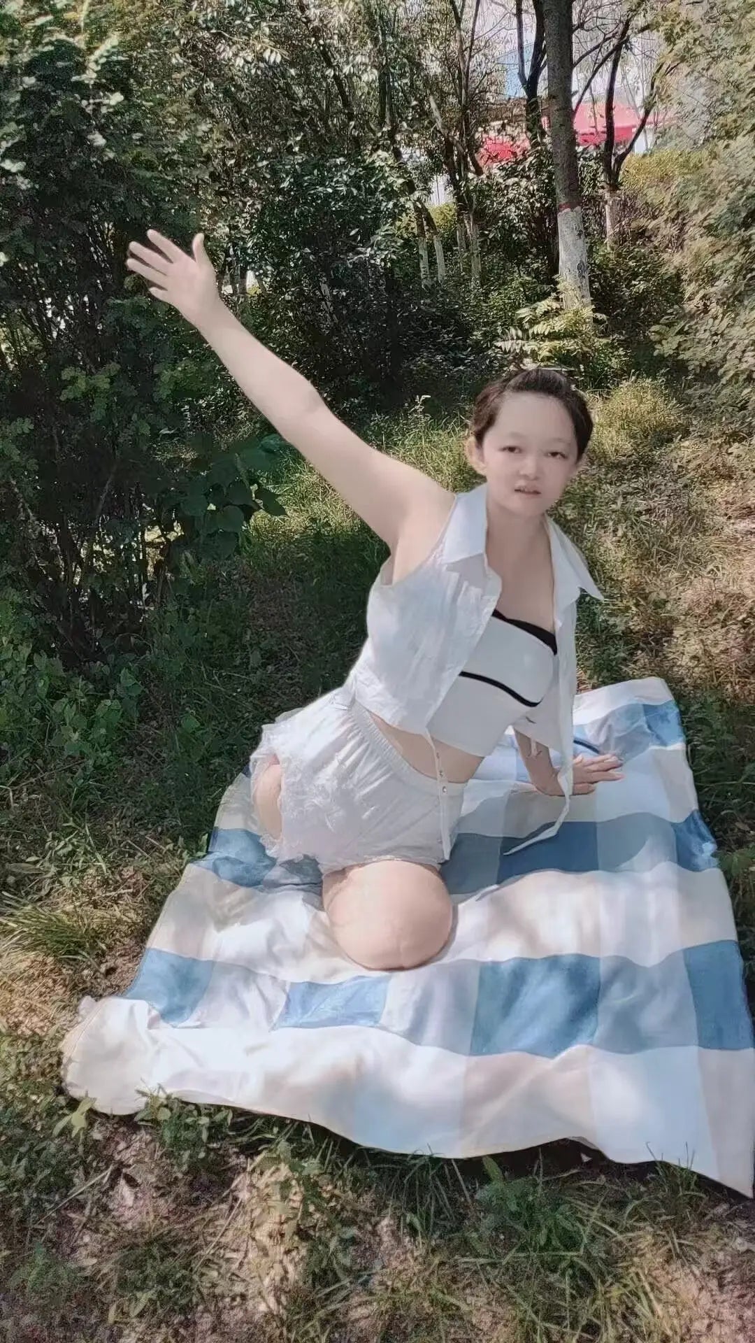 Sugar: Dak Amputee Girl - Legless girl walking outdoors AmputeeClub