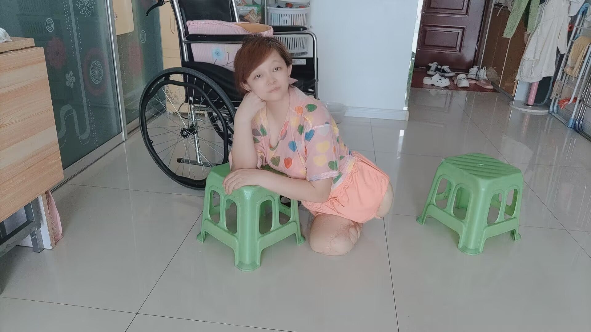 Sugar: Dak Amputee Girl - Get up early and exercise at home - AmputeeClub