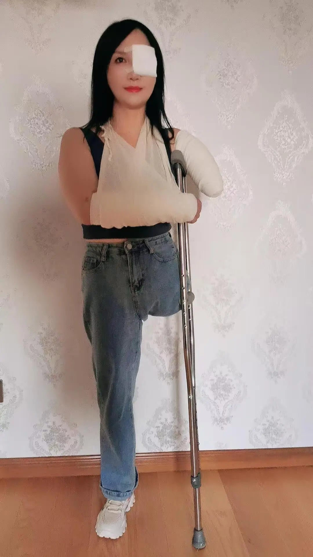 Lanzi OOE Amputee Girl - Injured limbs and eyes