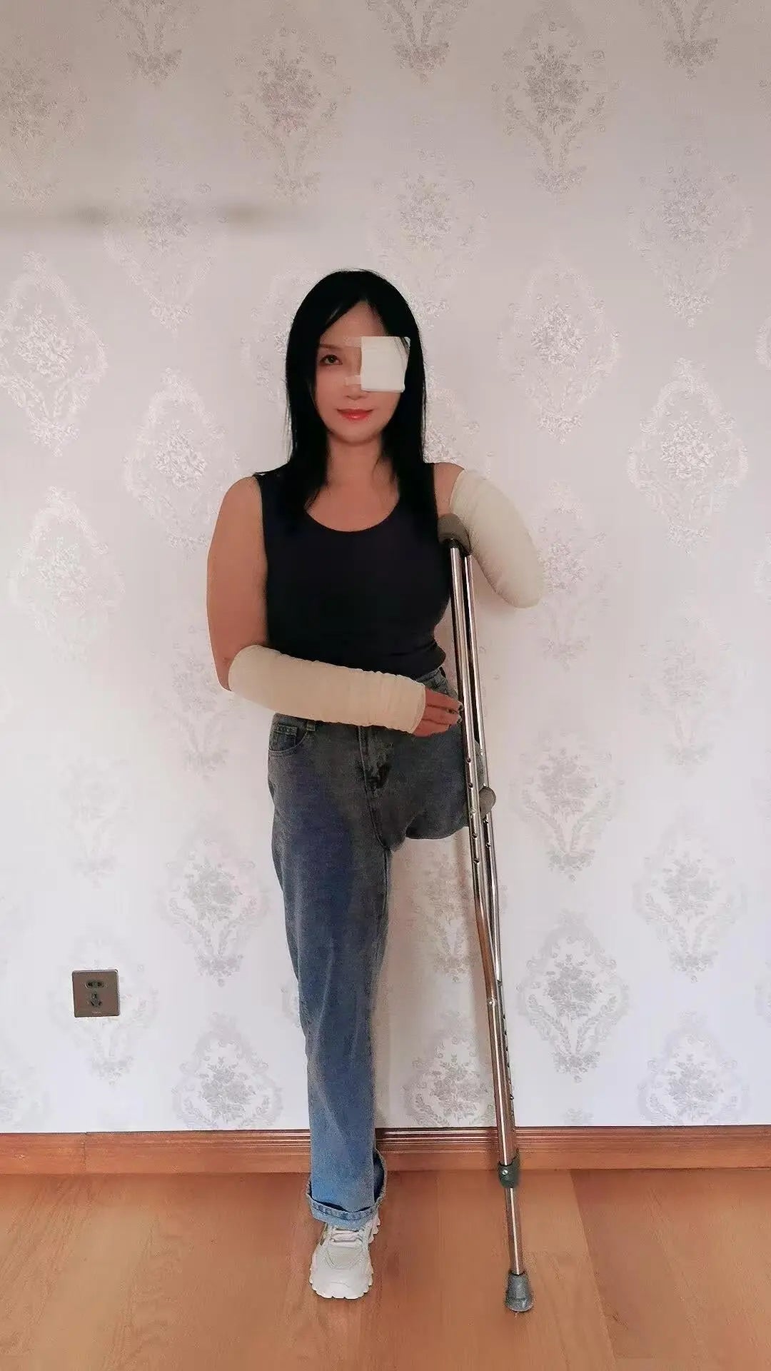 Lanzi OOE Amputee Girl - Injured limbs and eyes