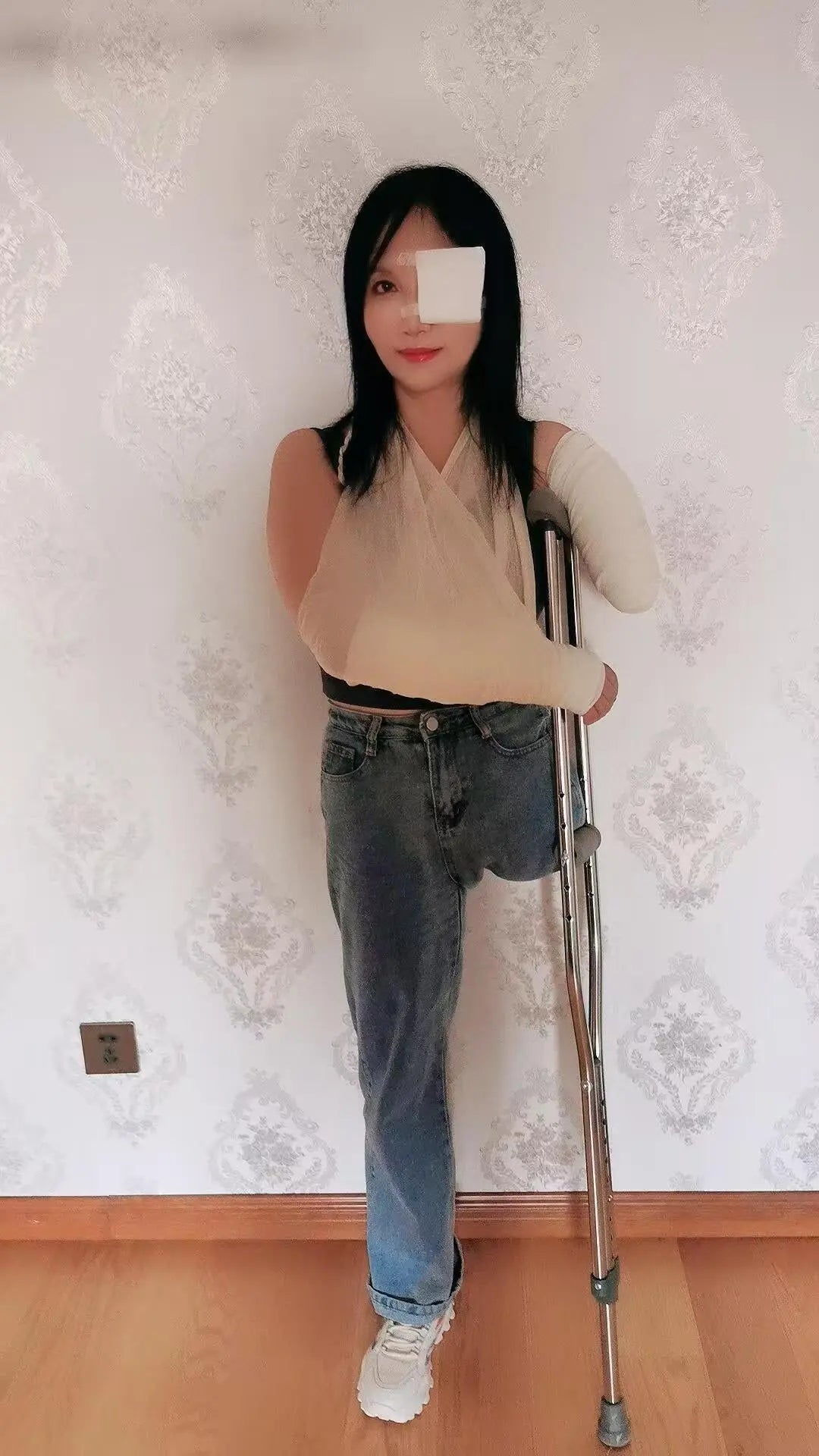 Lanzi OOE Amputee Girl - Injured limbs and eyes