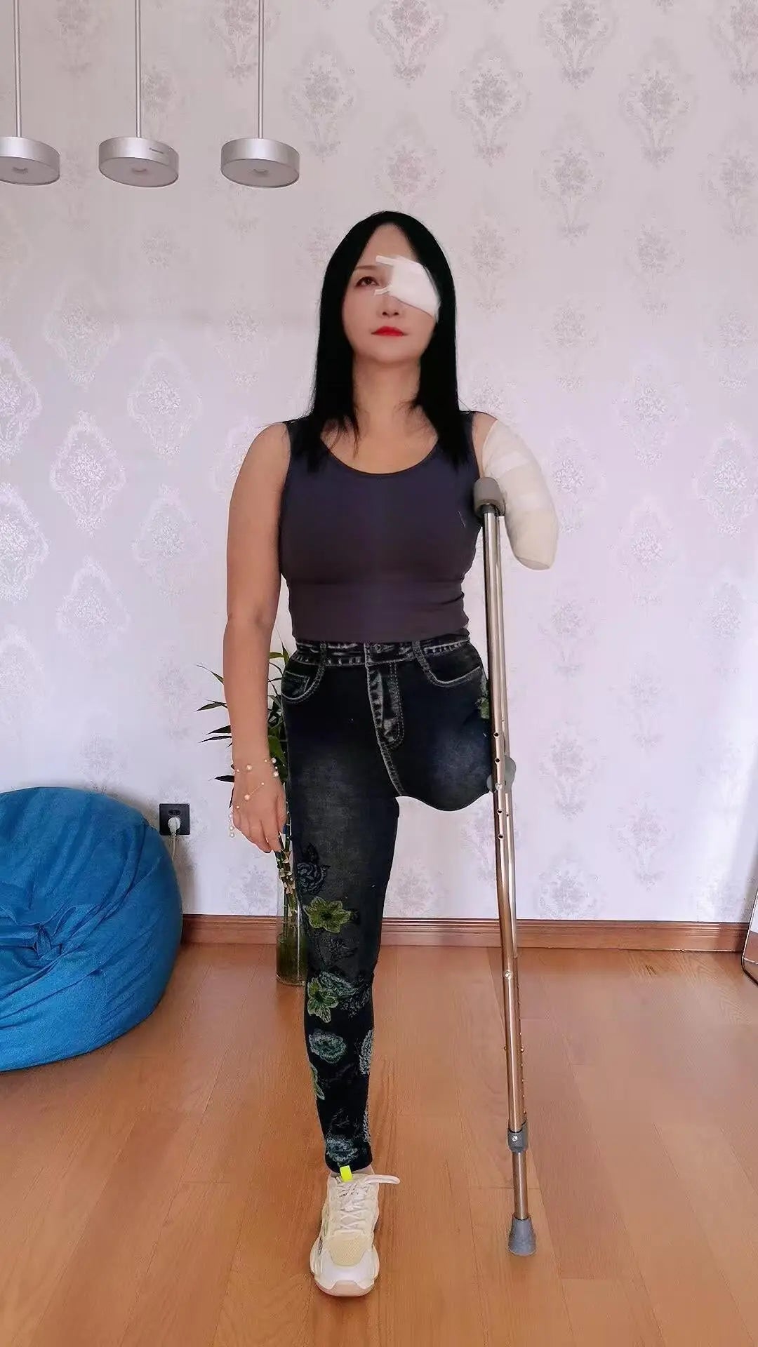 Lanzi OOE Amputee Girl - Injured limbs and eyes