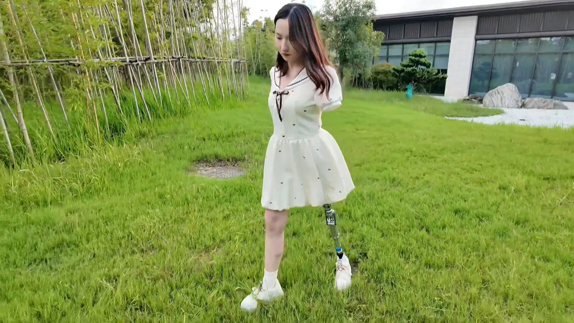 Beibei: Ooe Amputee Girl strolls in the park wearing prosthetic limbs AmputeeClub