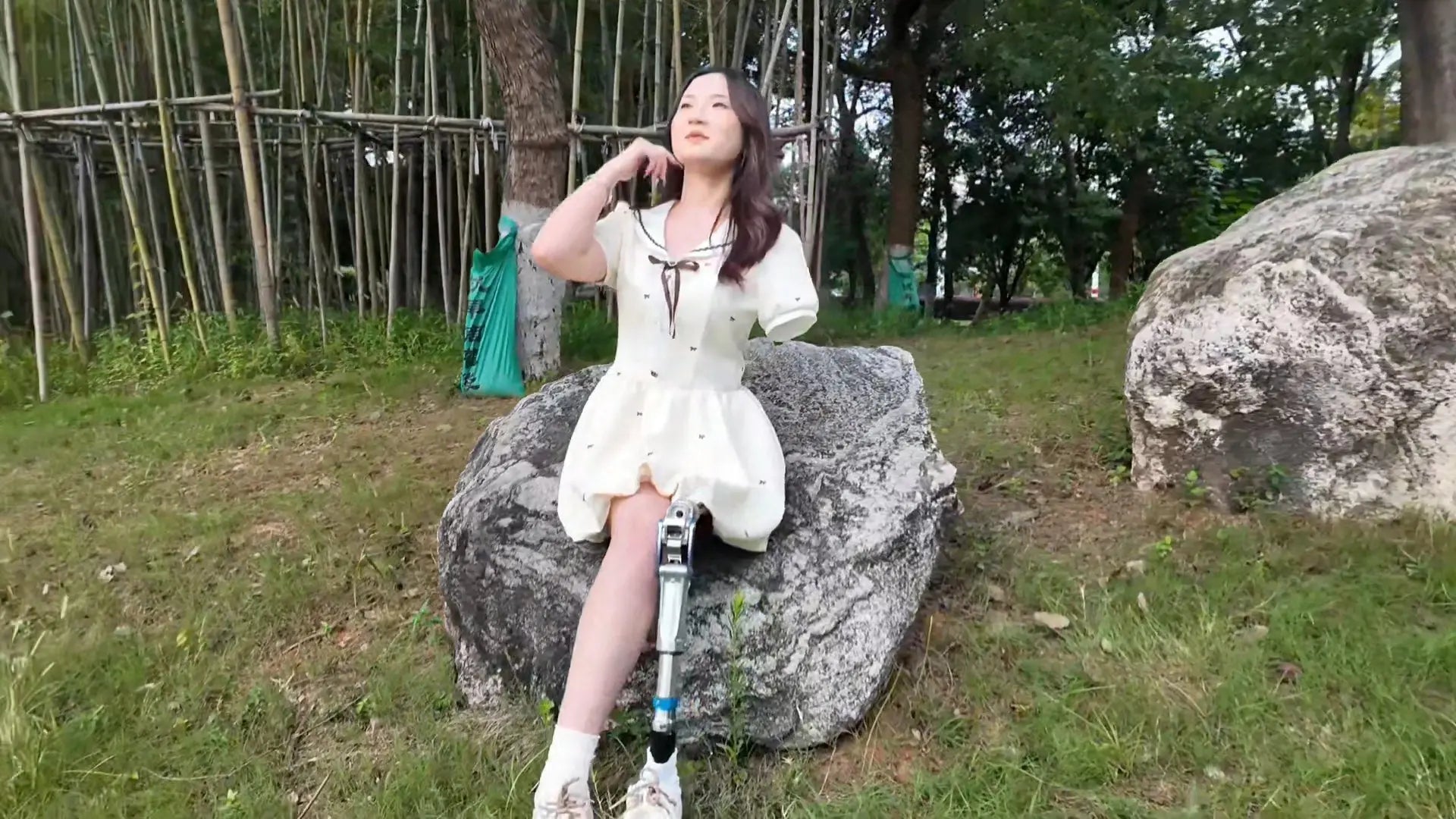 Beibei: Ooe Amputee Girl strolls in the park wearing prosthetic limbs AmputeeClub