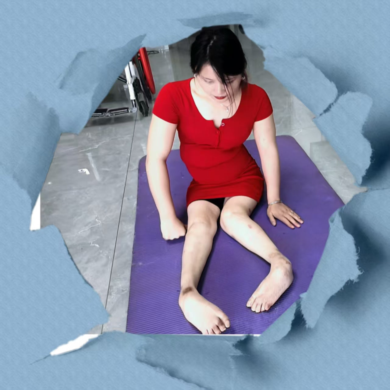 Shera: Paraplegic Girl's Yoga Training for Flexible Legs