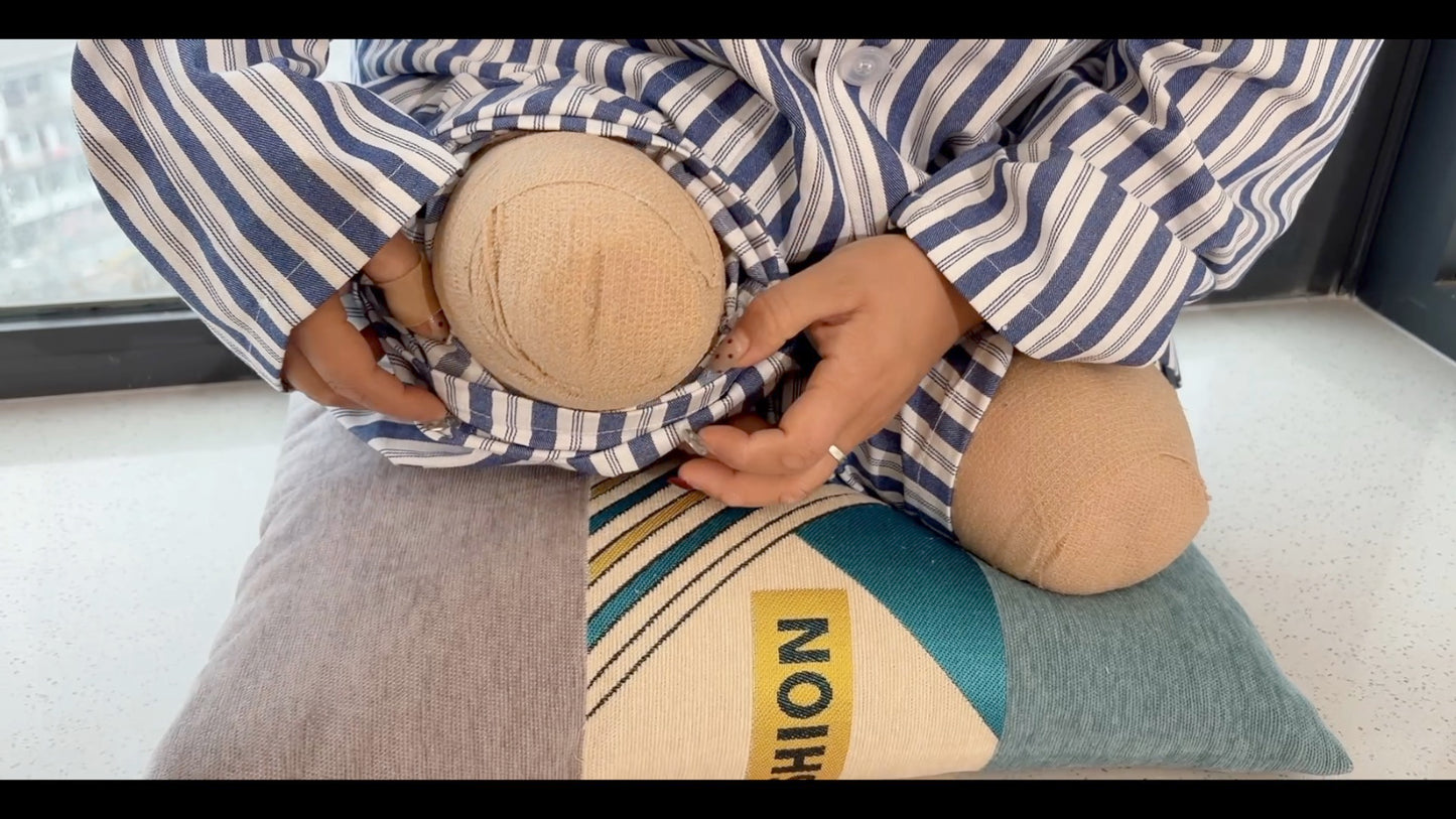 Tina, an Amputee Girl - Displaying her amputated limbs while wearing a hospital gown
