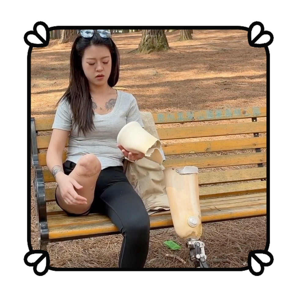Amy: Sak Amputee girl - Playing in the park wearing a prosthetic leg