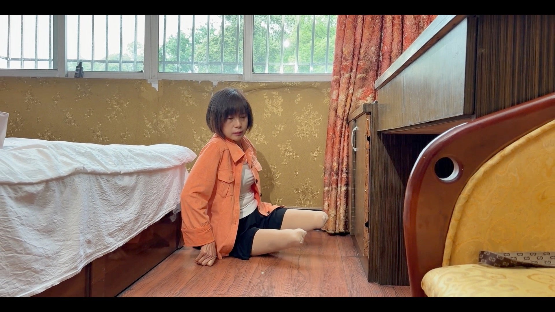 Juli: Triple Amputee Lady - Residual Limb Care