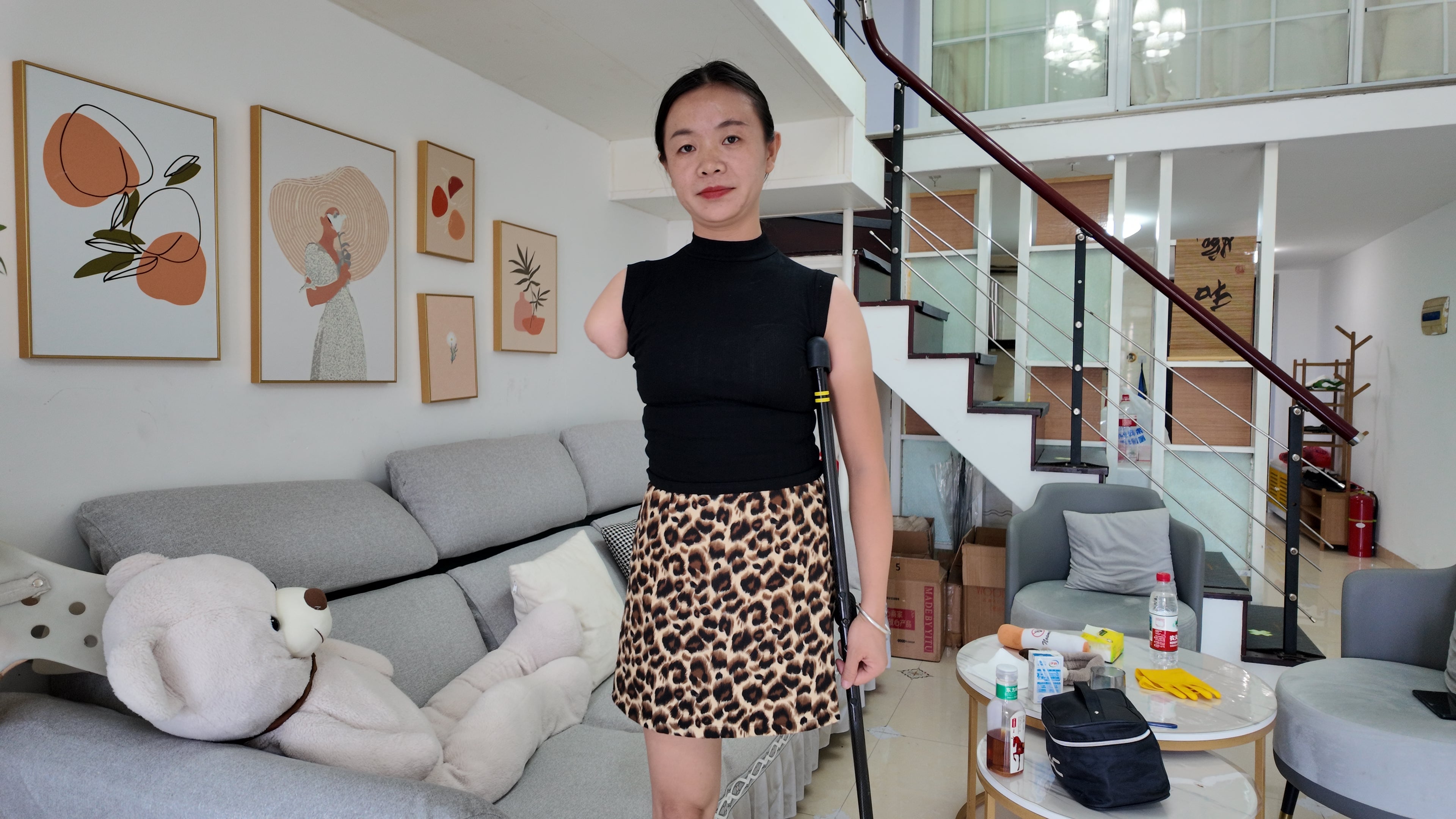 Mila The Ooe Amputee Girl showcases comprehensive residual limb care