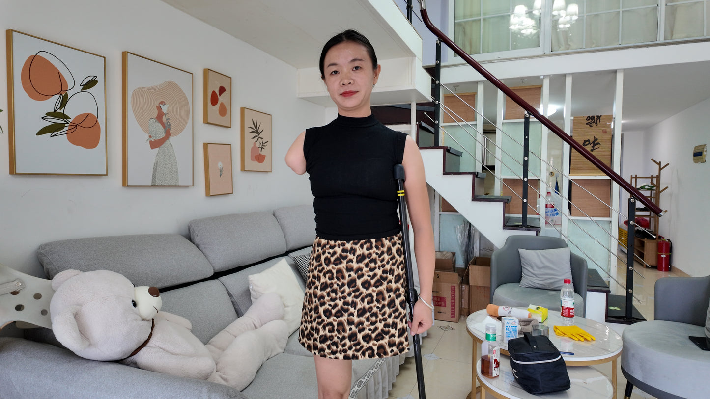 Mila The Ooe Amputee Girl showcases comprehensive residual limb care