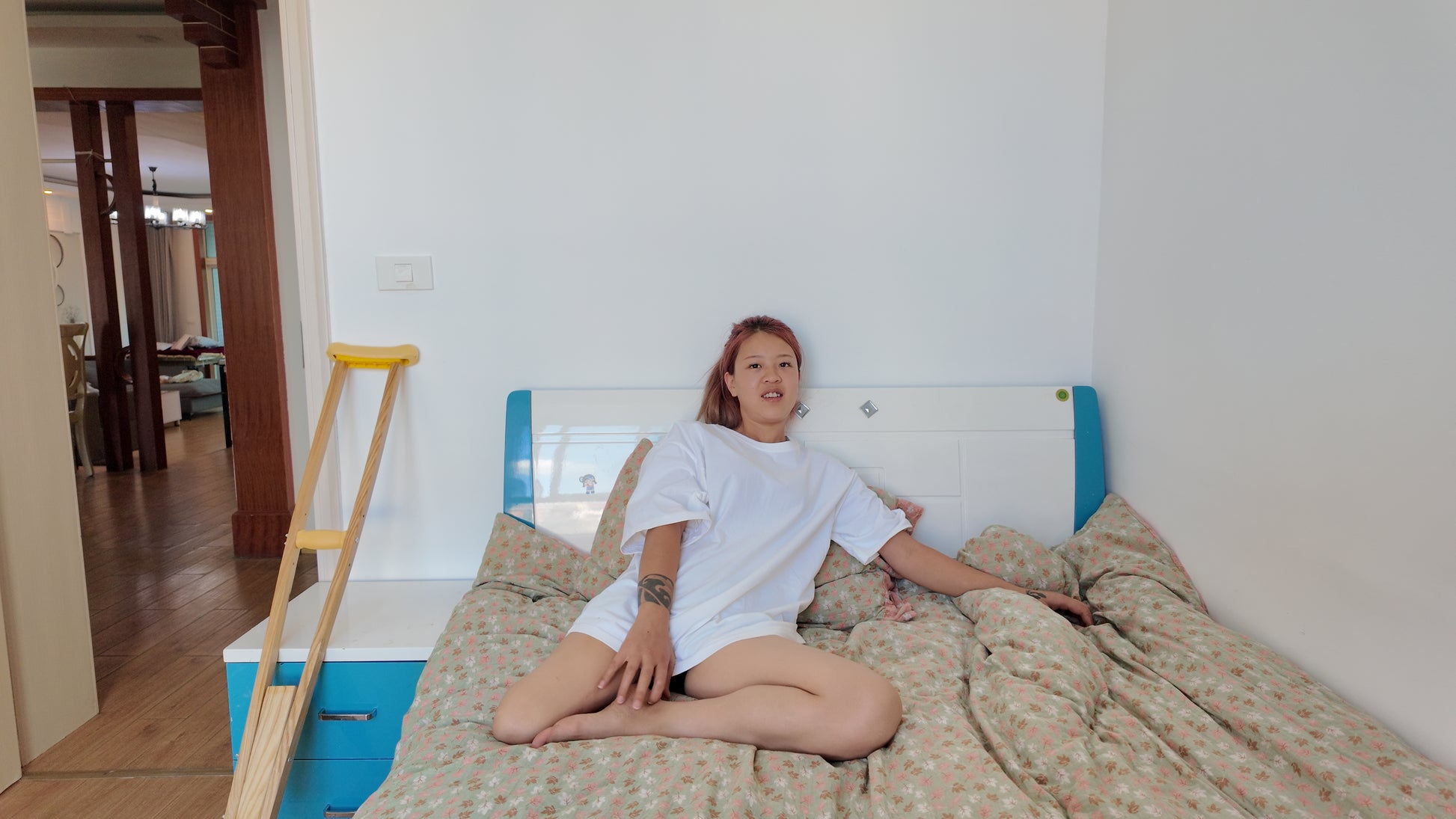 Amy: Sak Amputee girl cares for and relieves residual limb pain