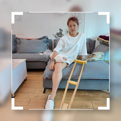 Amy: Sak Amputee girl cares for and relieves residual limb pain