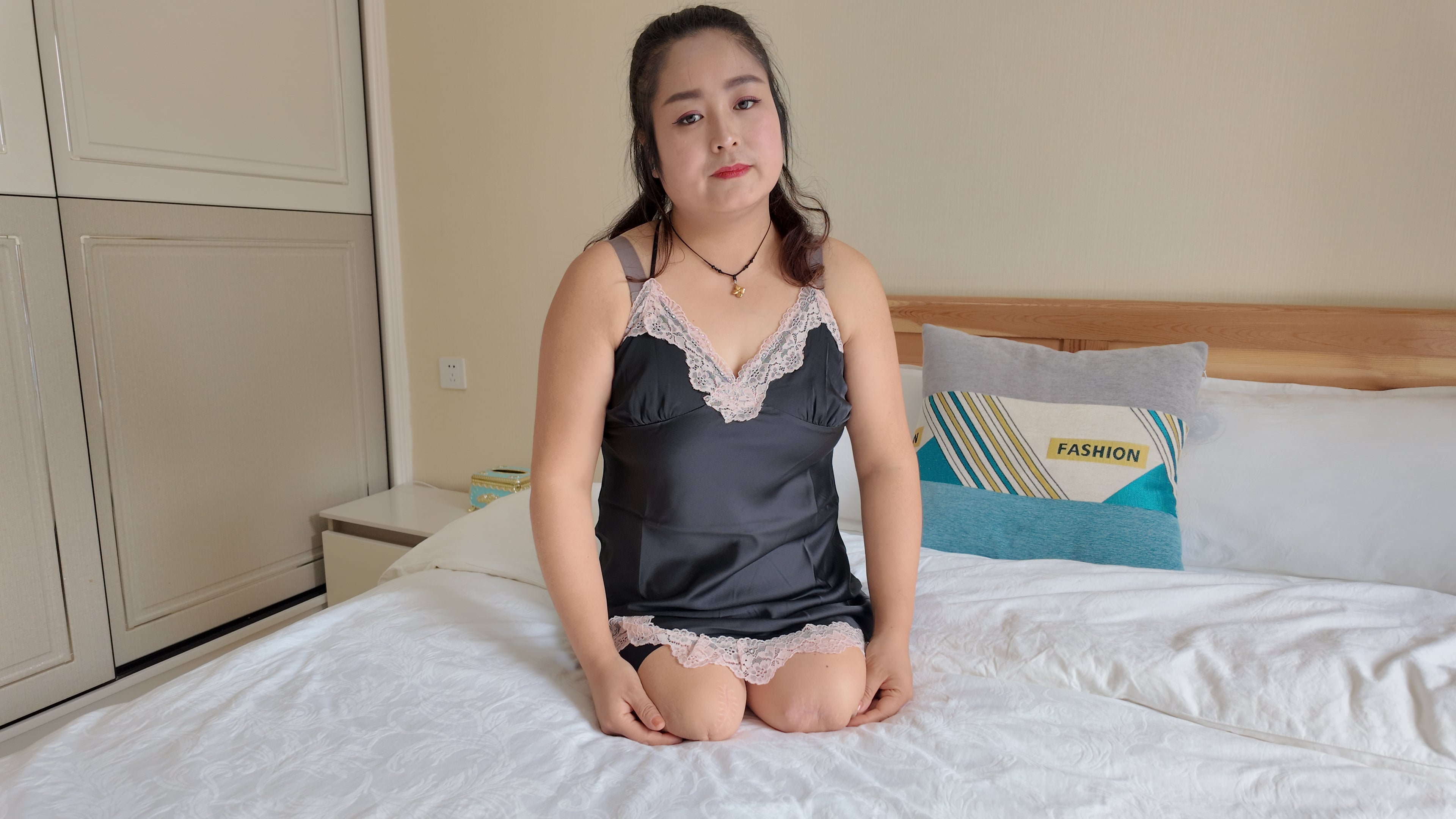 Tina, an amputee girl, wearing stockings with her amputated limbs.