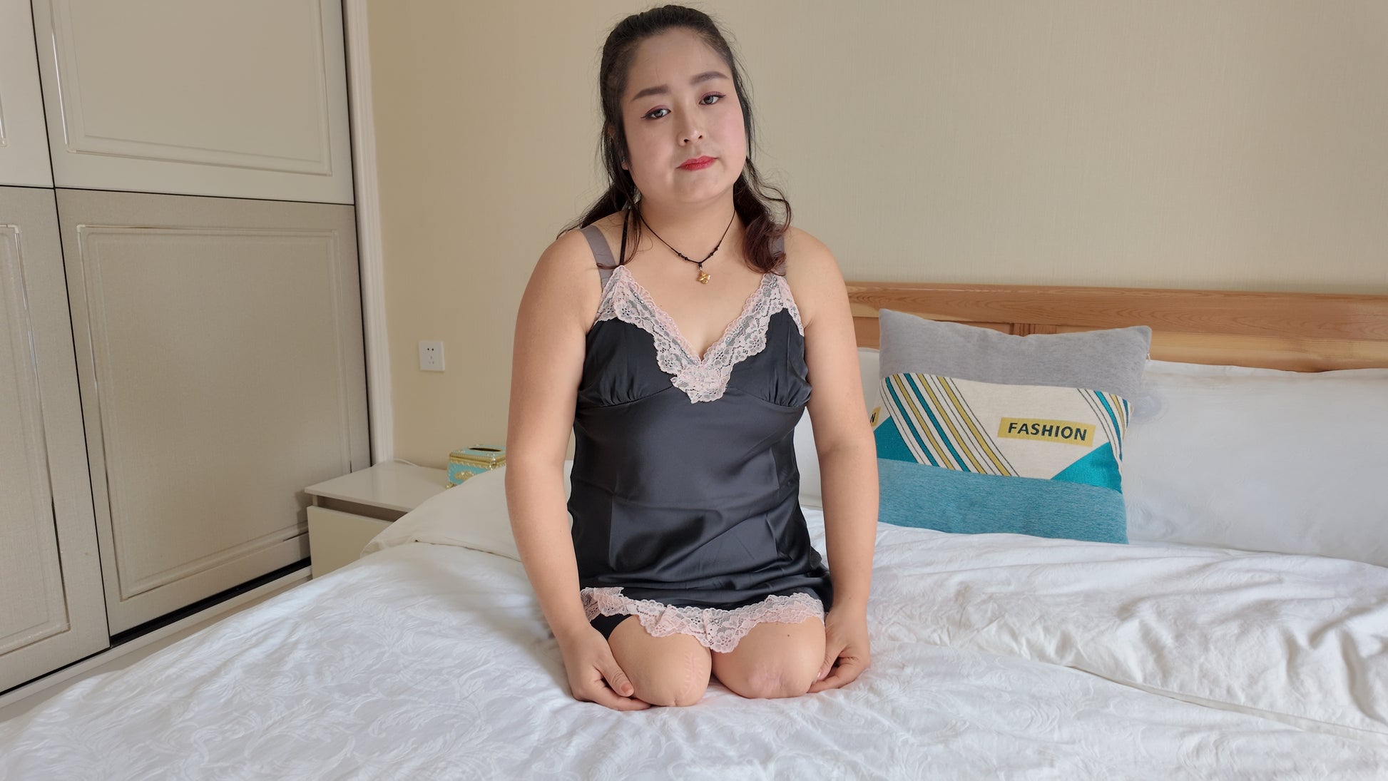 Tina, an amputee girl, wearing stockings with her amputated limbs.