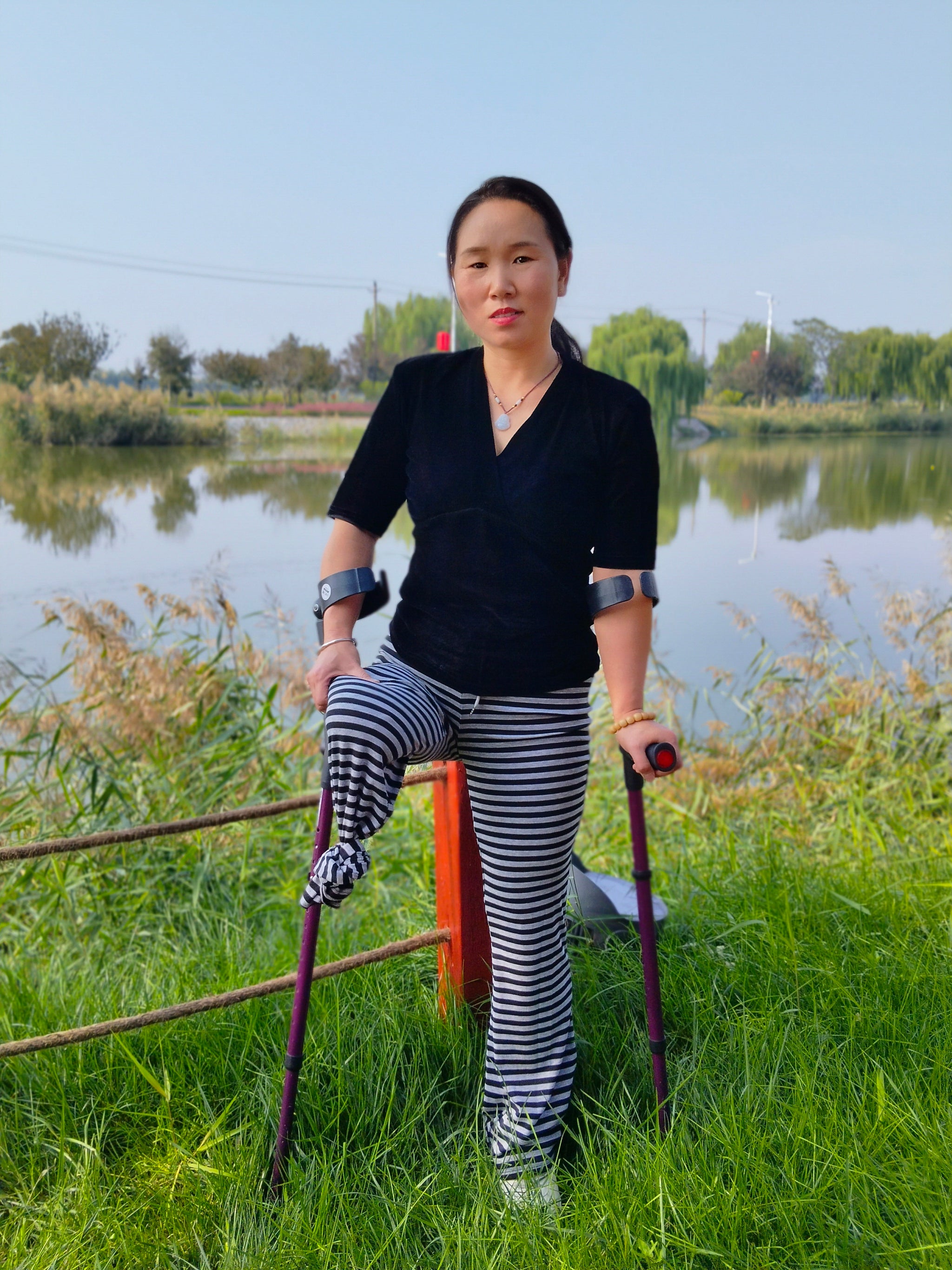 Gigi: Sak Amputee Girl - Using elbow crutches to go out for a walk in spring.