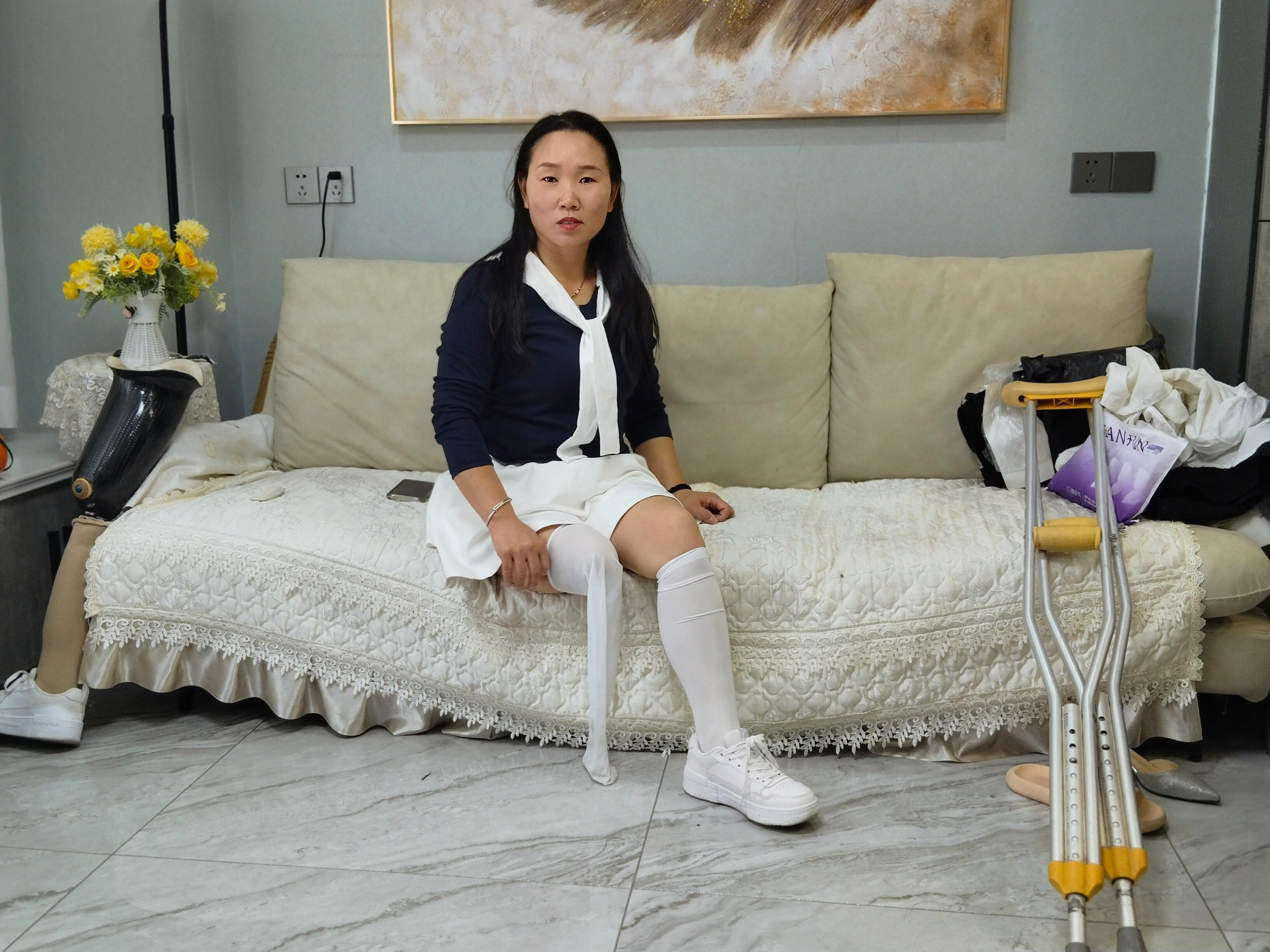 Gigi: Sak Amputee Girl - Relieving Phantom Limb Pain