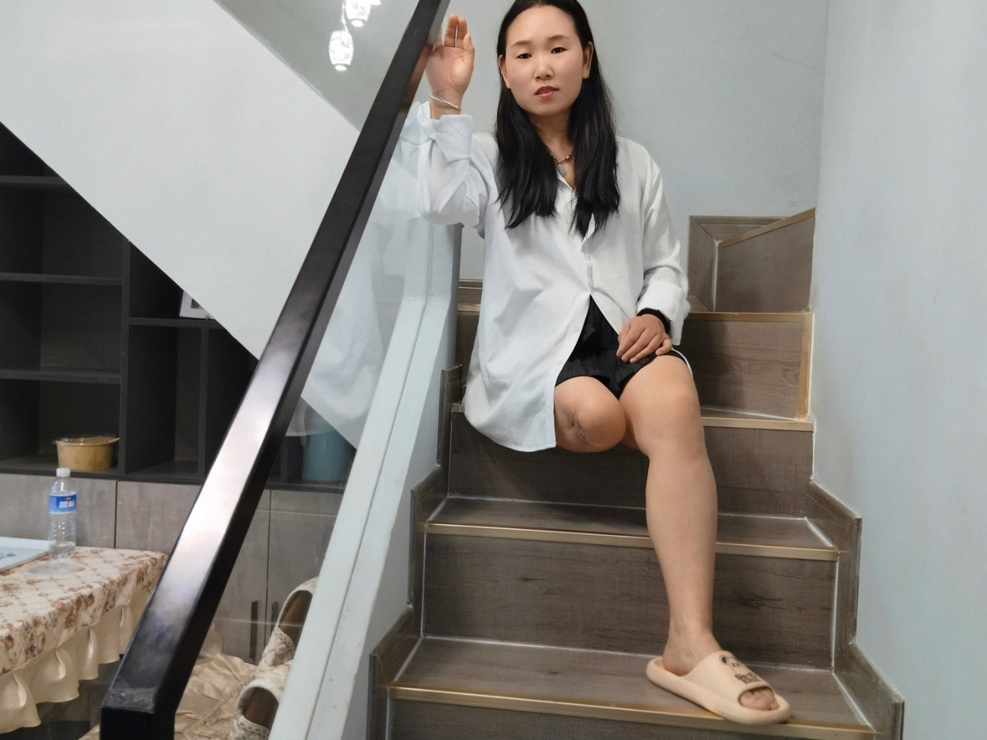 Gigi: Sak Amputee Girl generously displays her amputated limbs