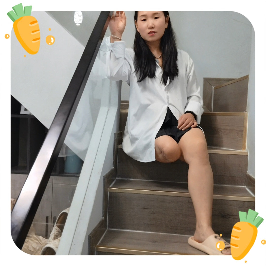 Gigi: Sak Amputee Girl generously displays her amputated limbs