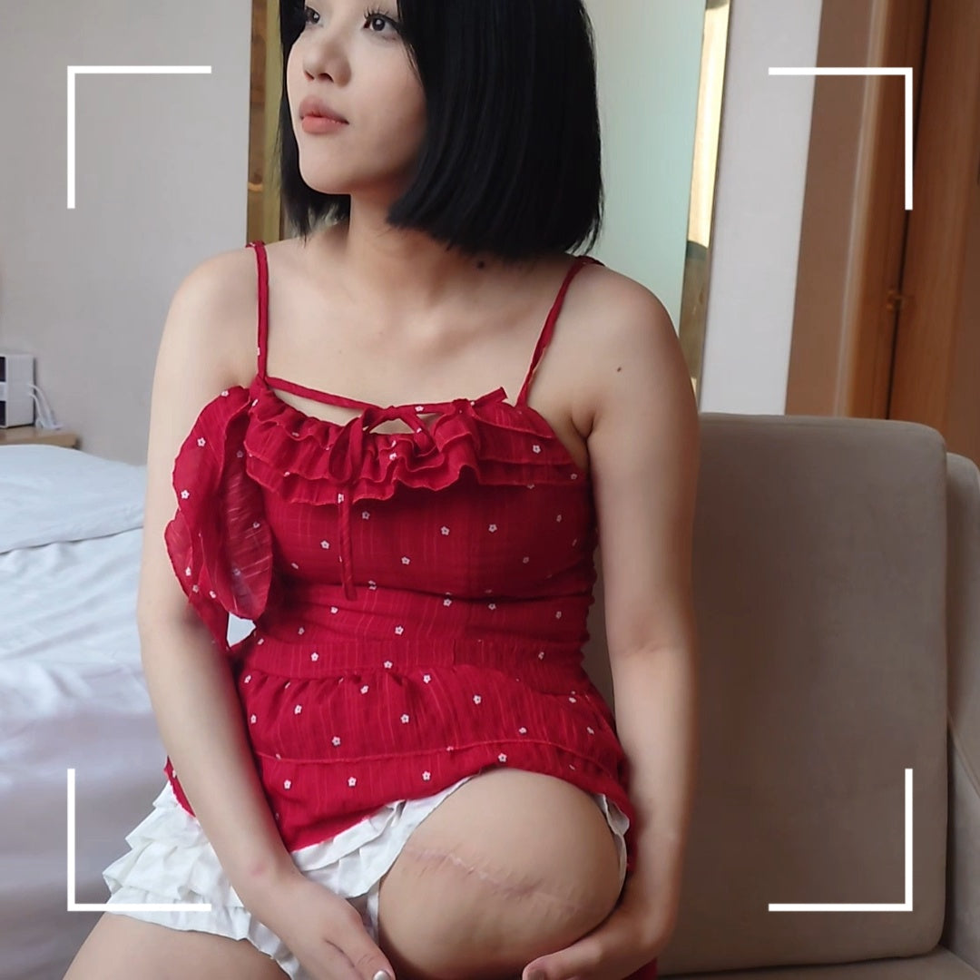 Lingo: Sak Amputee Girl wears a red strappy dress, showcasing her amputated limb
