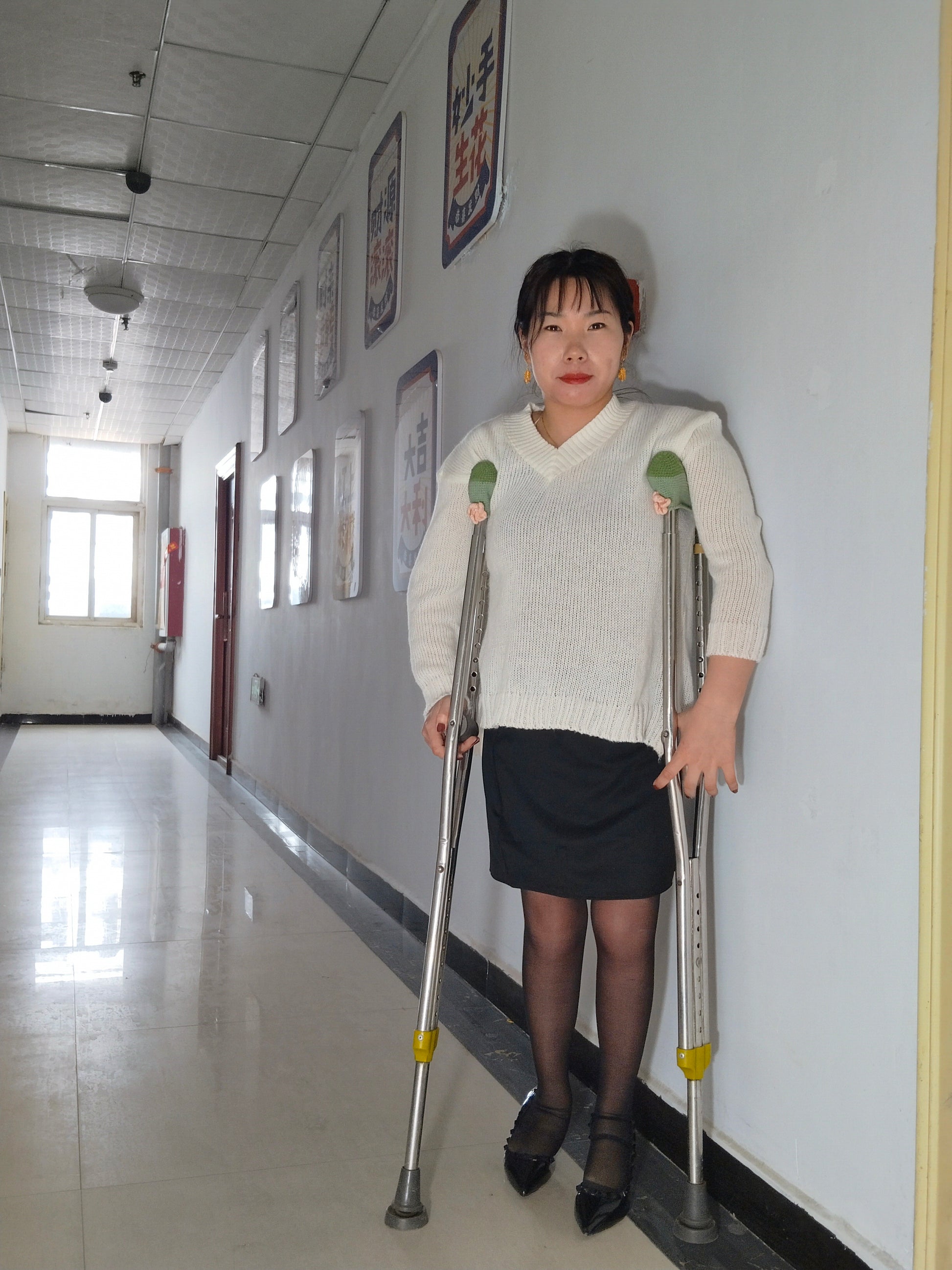 Twlia, a girl with polio - high heels and stockings going up and down stairs