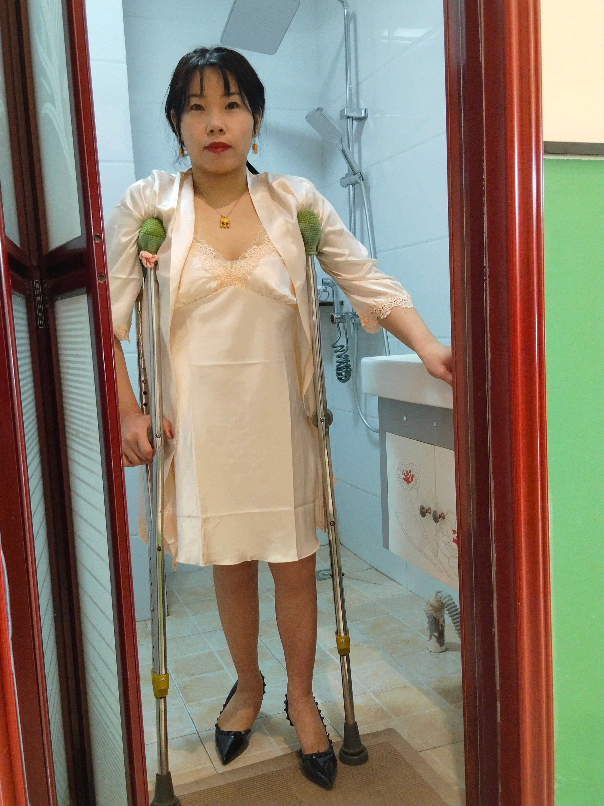 Twlia, a girl with polio - deformed leg wrapped in bandages and using crutches