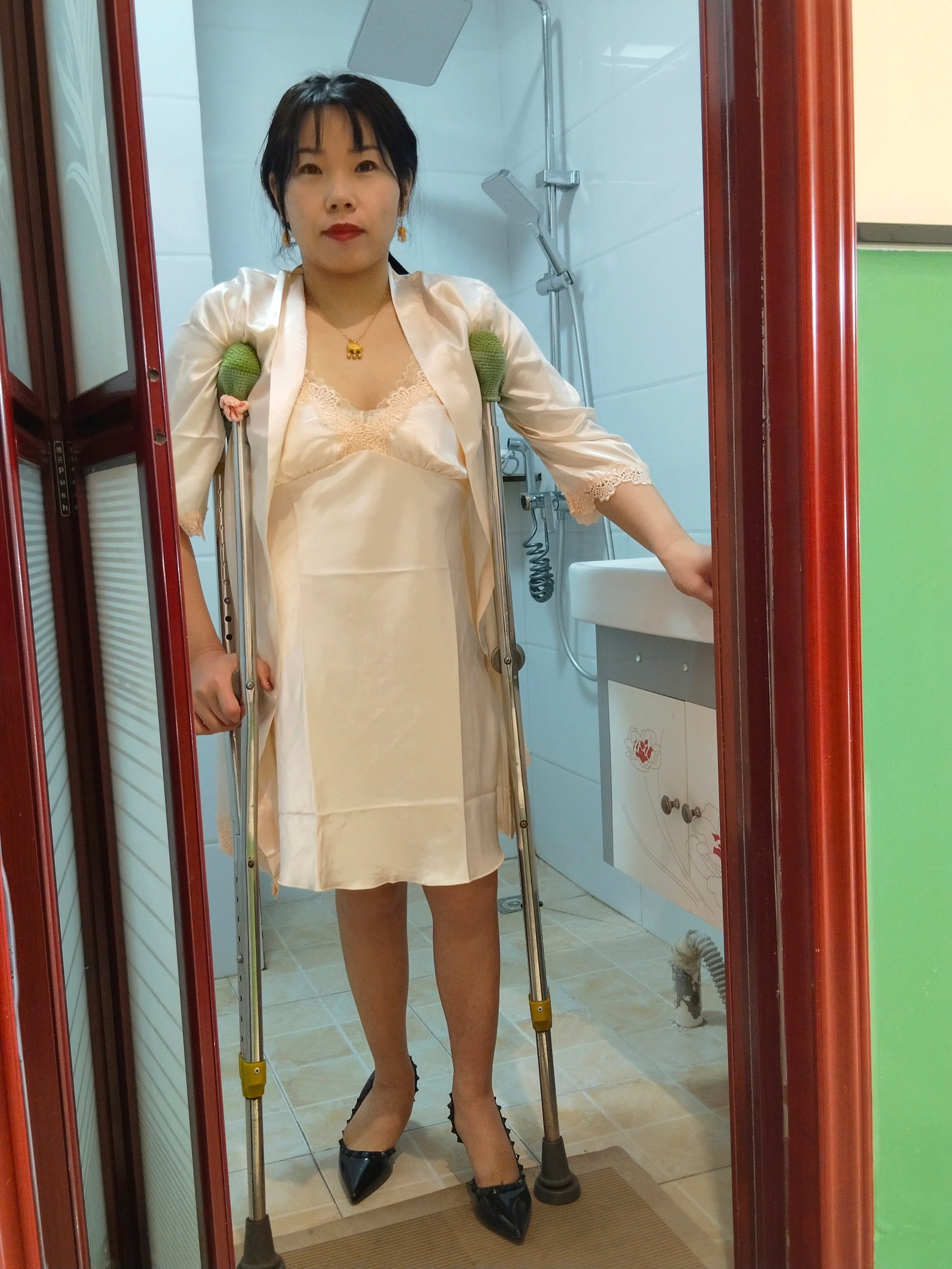 Twlia, a girl with polio - deformed leg wrapped in bandages and using crutches