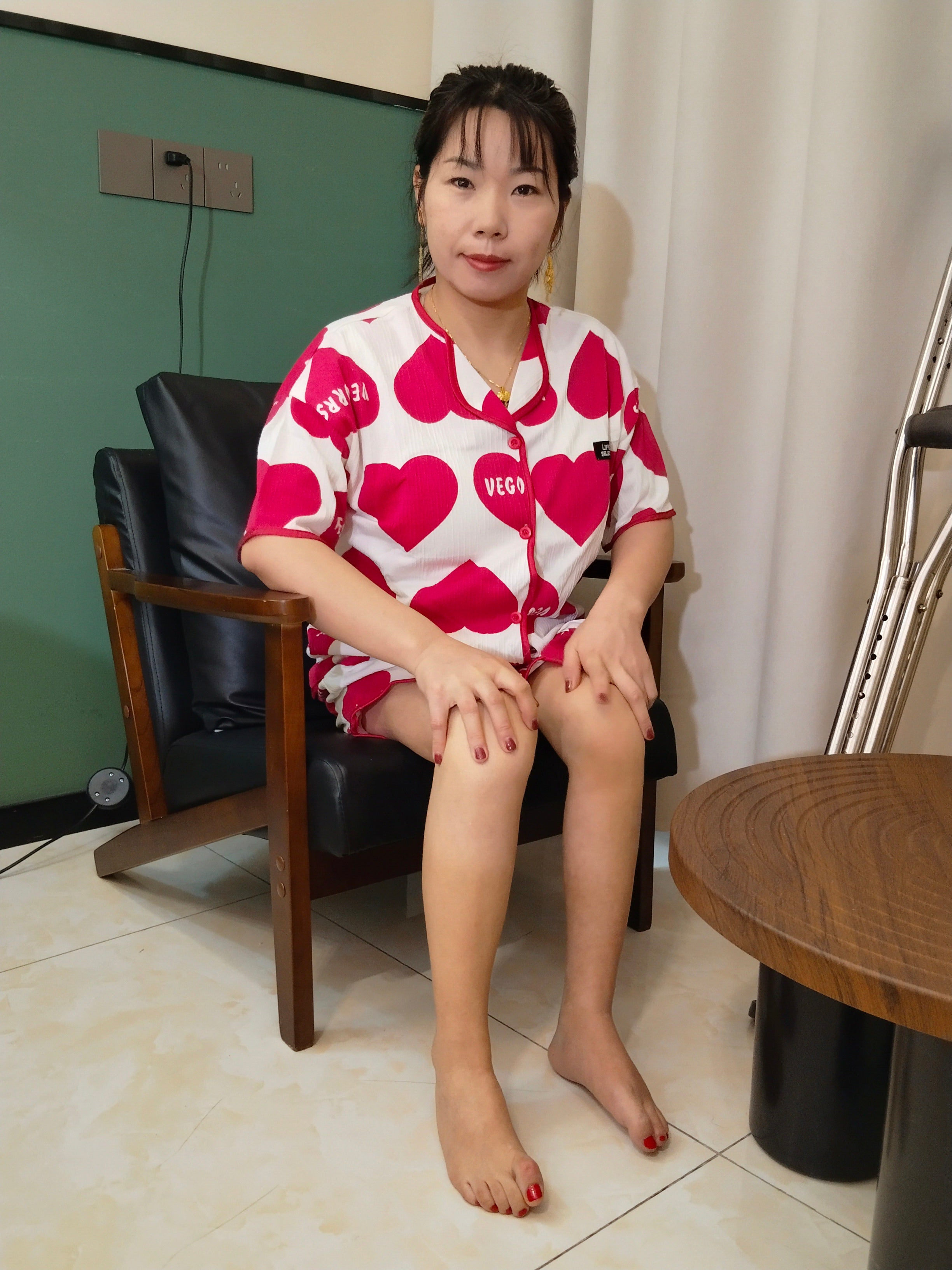 Twlia, a girl with polio- trying on high heels with deformed feet