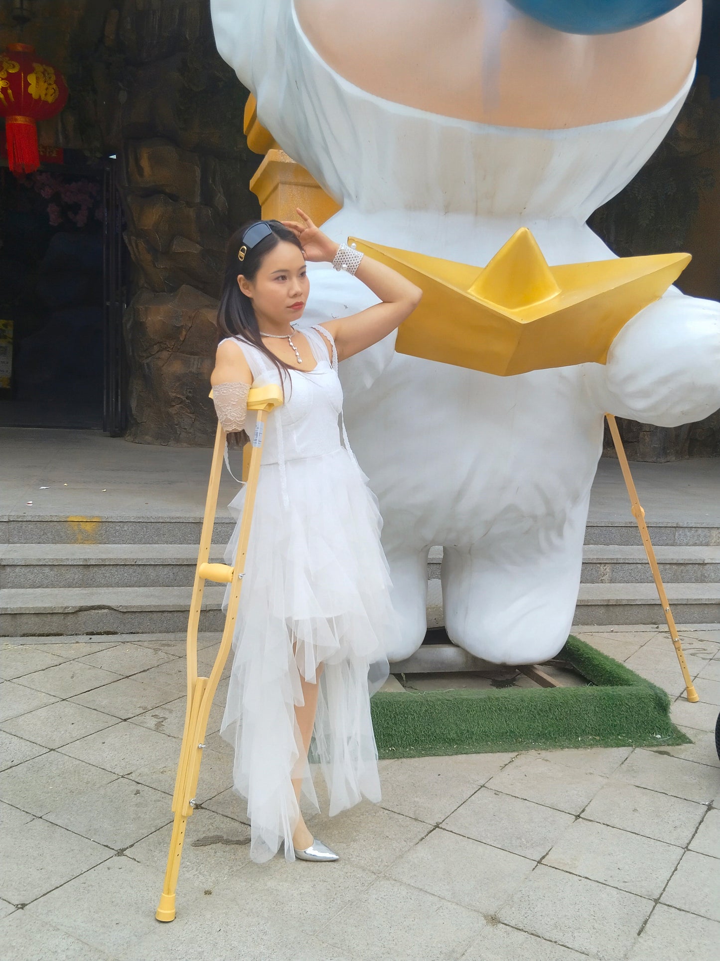 Abby Ooe, the Amputee Girl — Tragedy in the Romantic Town