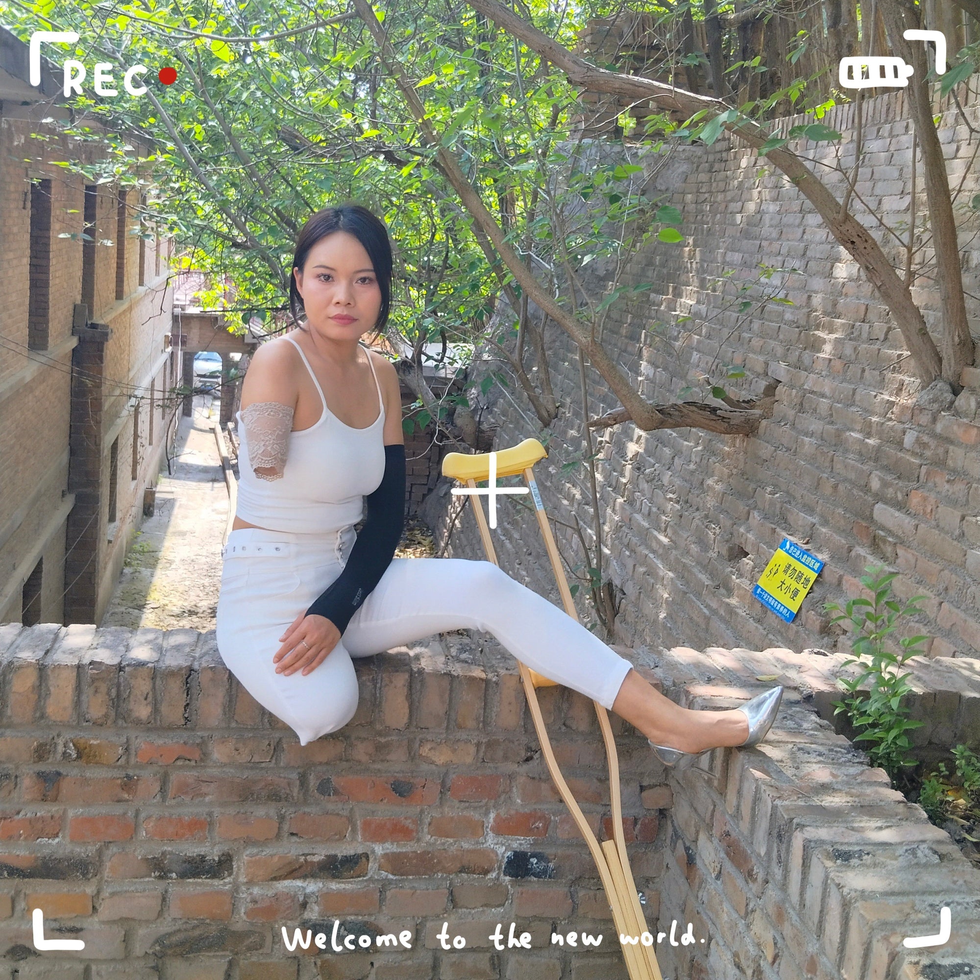 Abby Ooe, the Amputee Girl – Crutch-Assisted Adventure